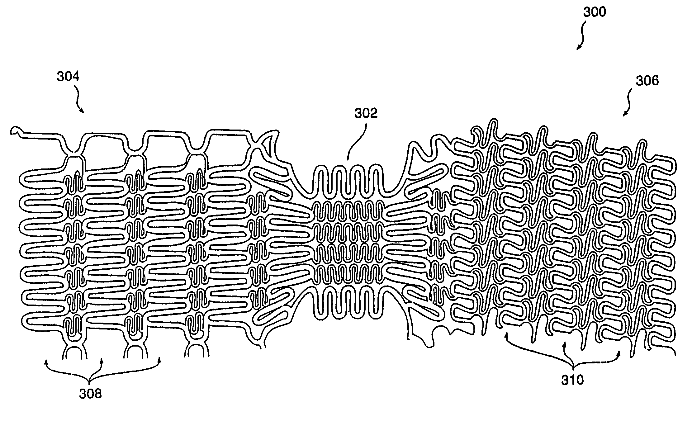 Extendible stent apparatus