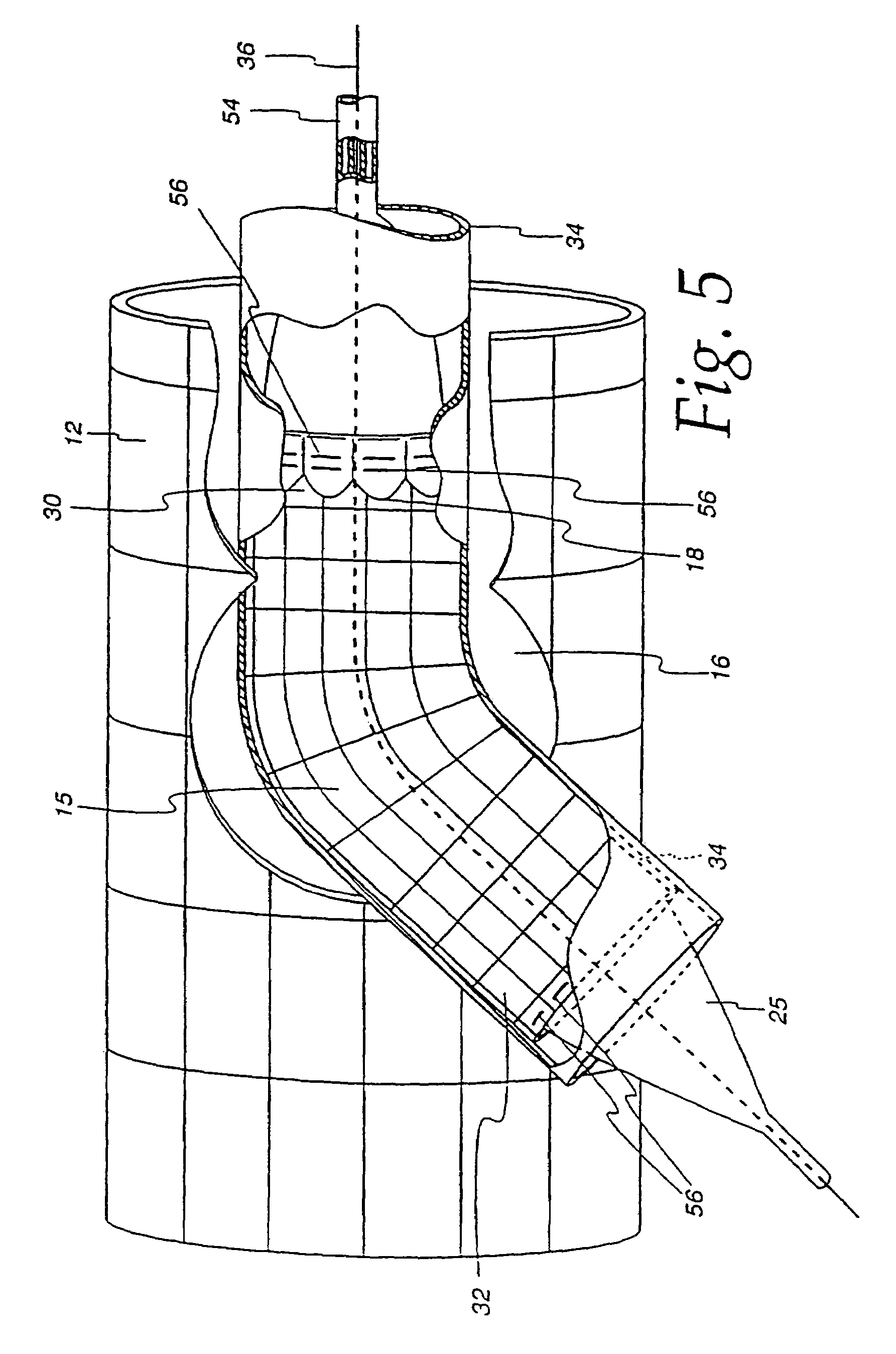 Extendible stent apparatus