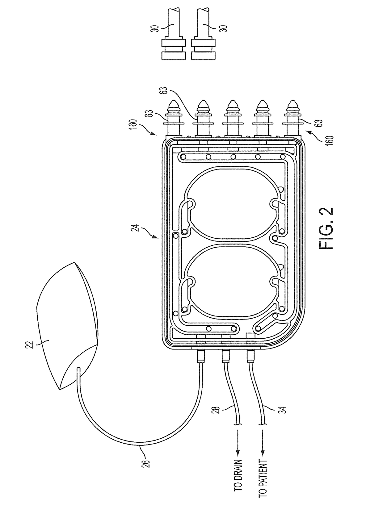 Medical treatment system and methods using a plurality of fluid lines