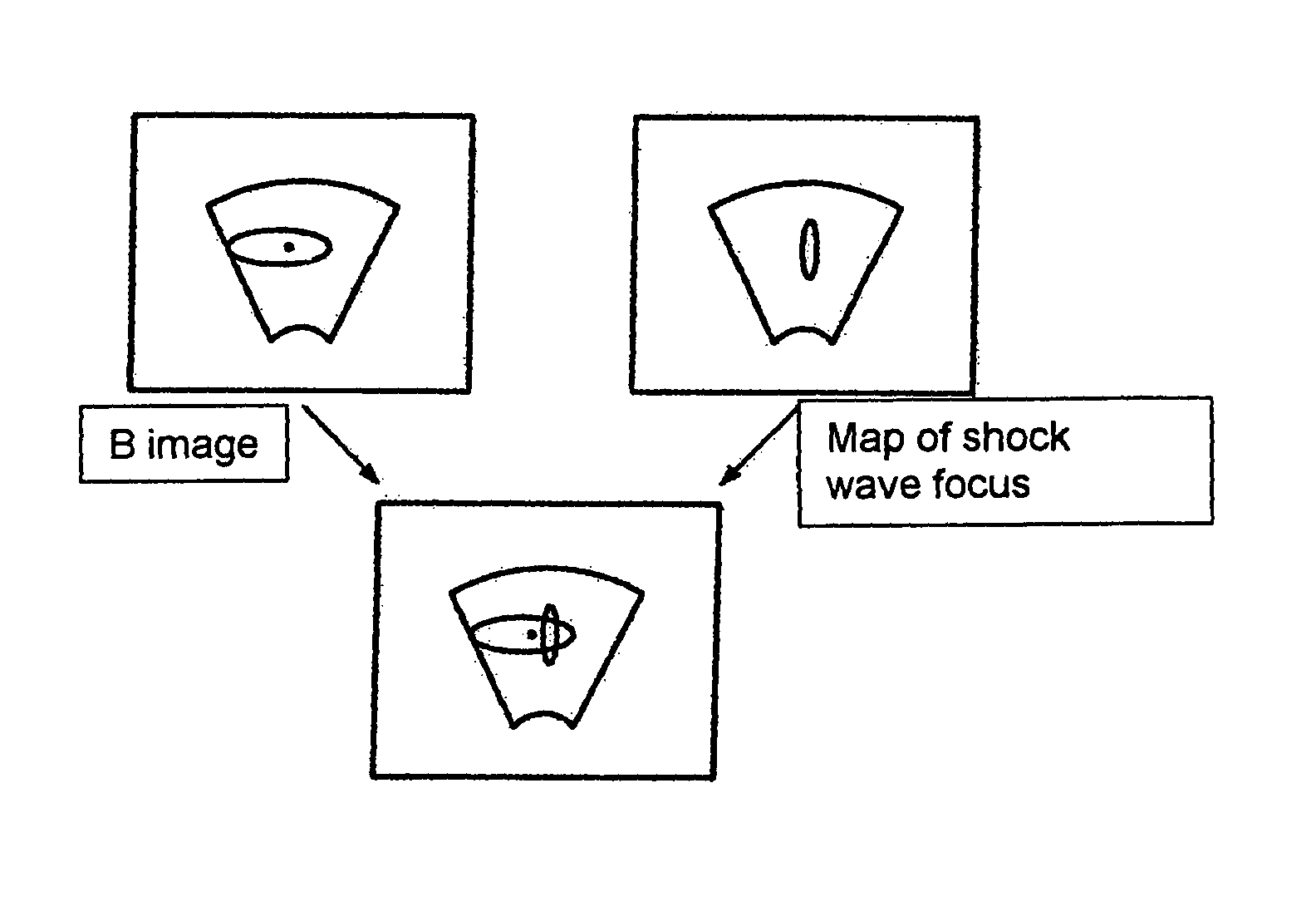 Shock wave therapy device with image production