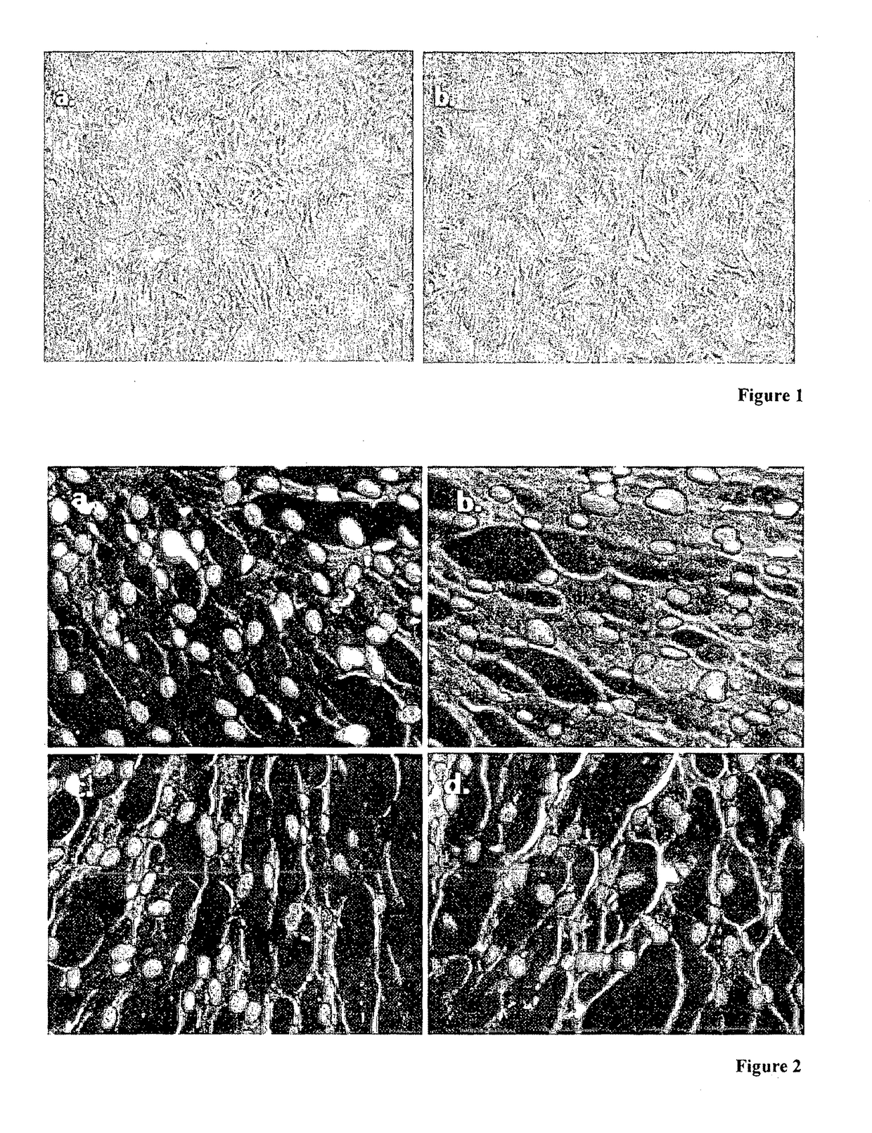 Application of stem cells in the orthodontic maxillary expansion