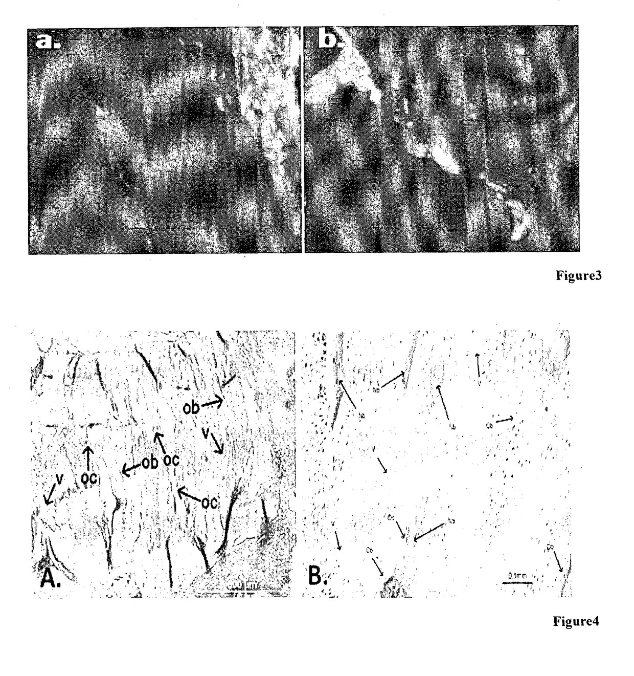 Application of stem cells in the orthodontic maxillary expansion