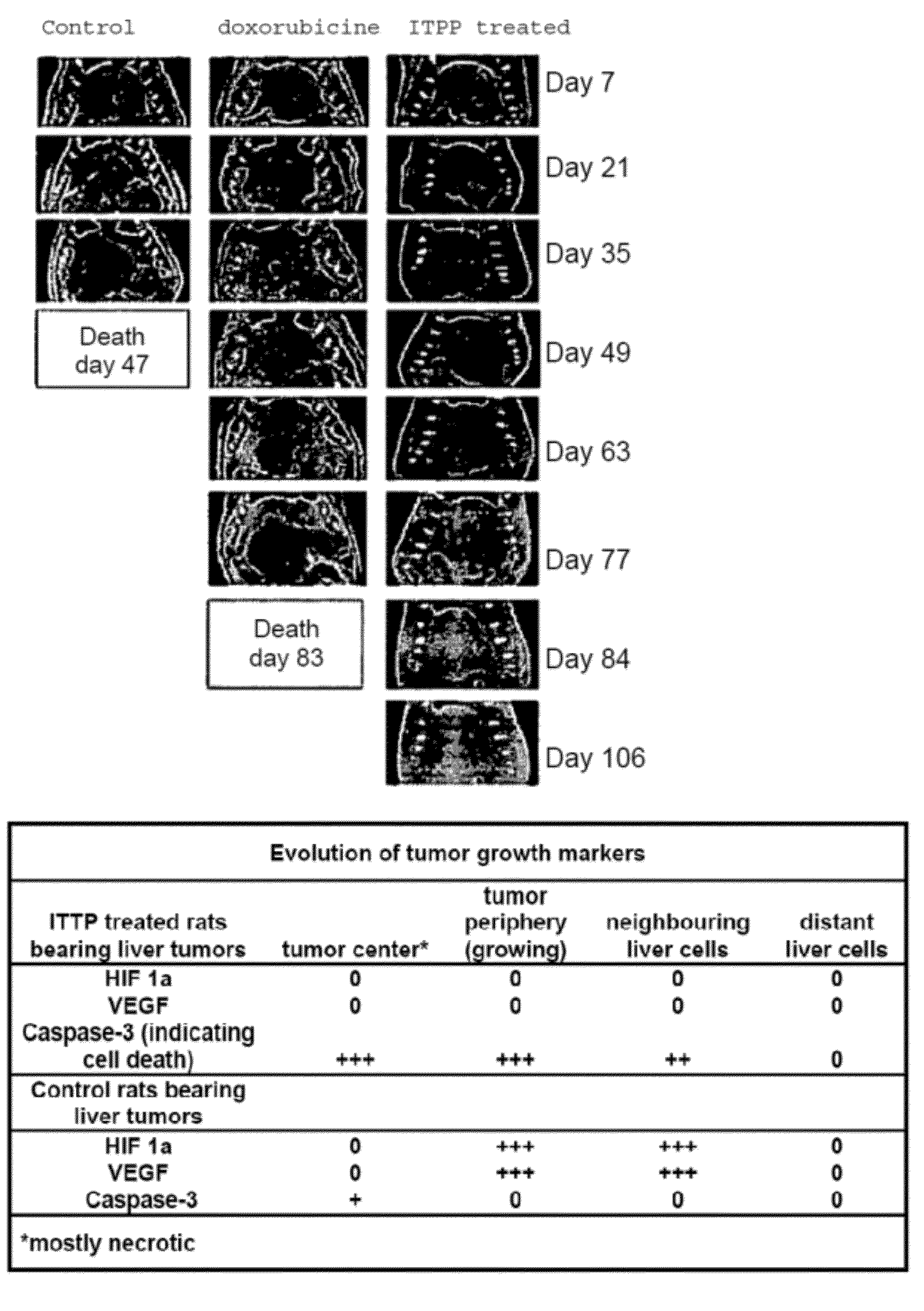 Tumor eradication by inositol-tripyrophosphate