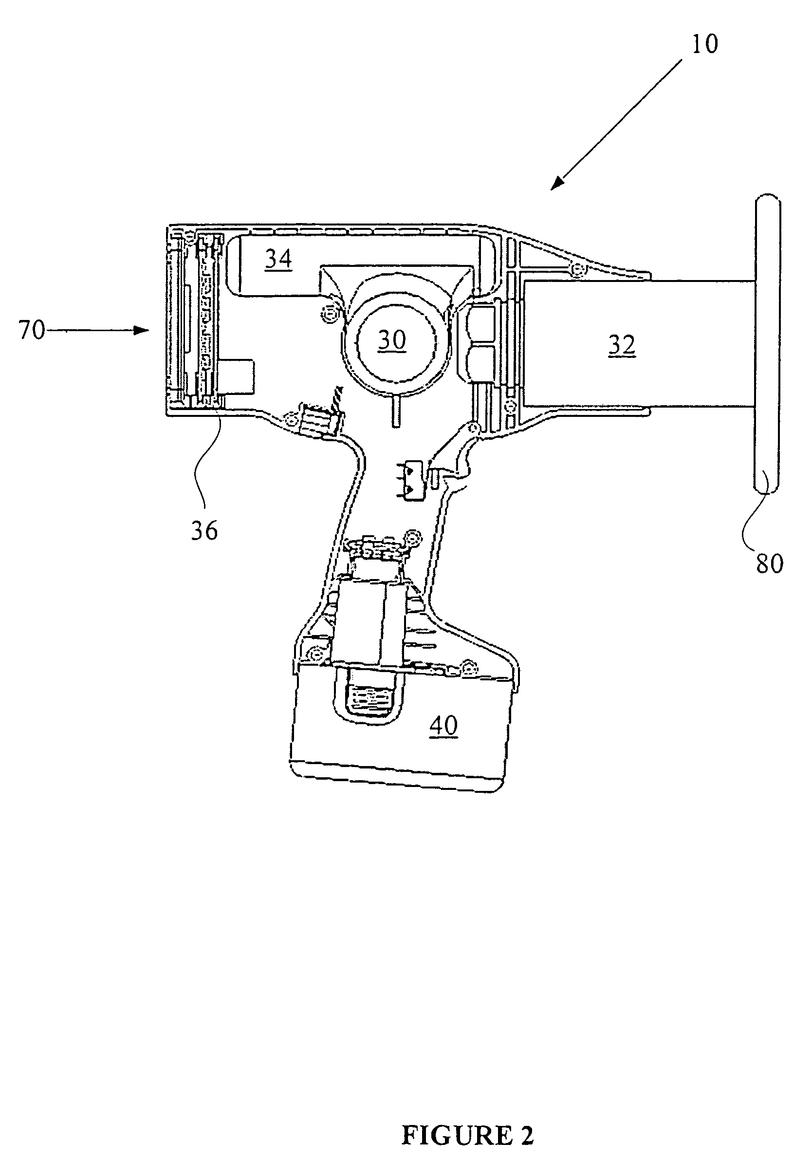 Digital x-ray camera