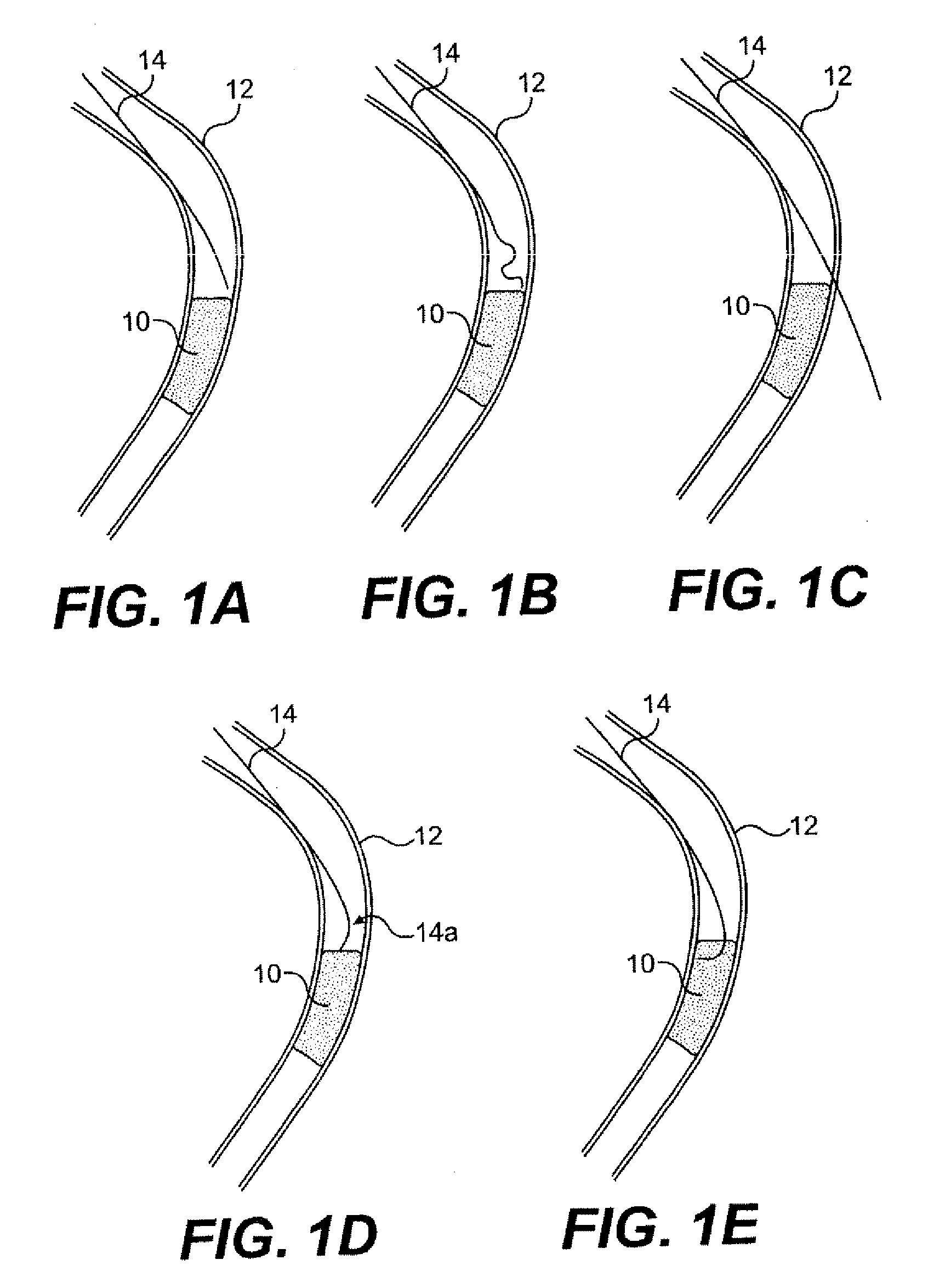 Guide wire control catheter for crossing occlusions and related methods of use