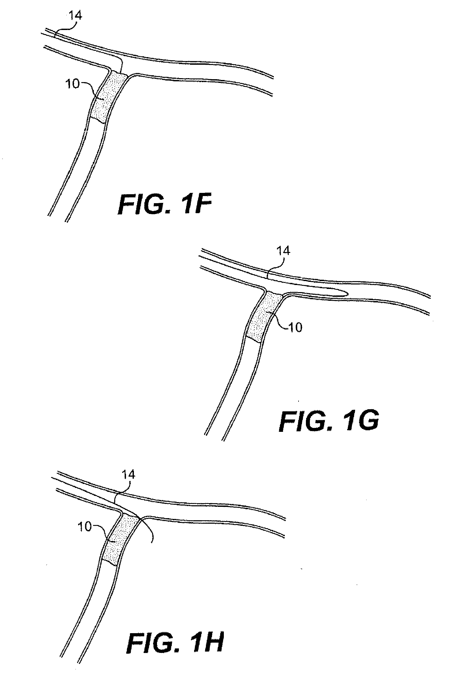 Guide wire control catheter for crossing occlusions and related methods of use