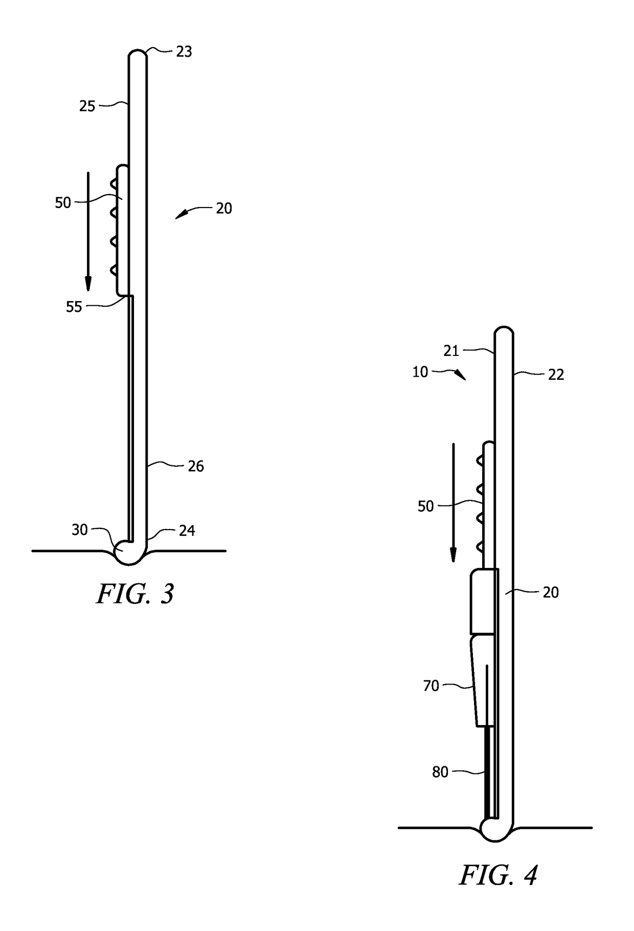 Device and method for treating retinal detachment