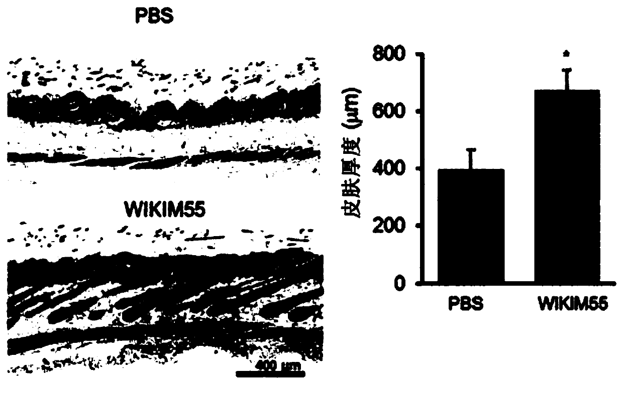 Lactobacillus curvatus wikim55 having activity of promoting hair growth, and composition containing same.