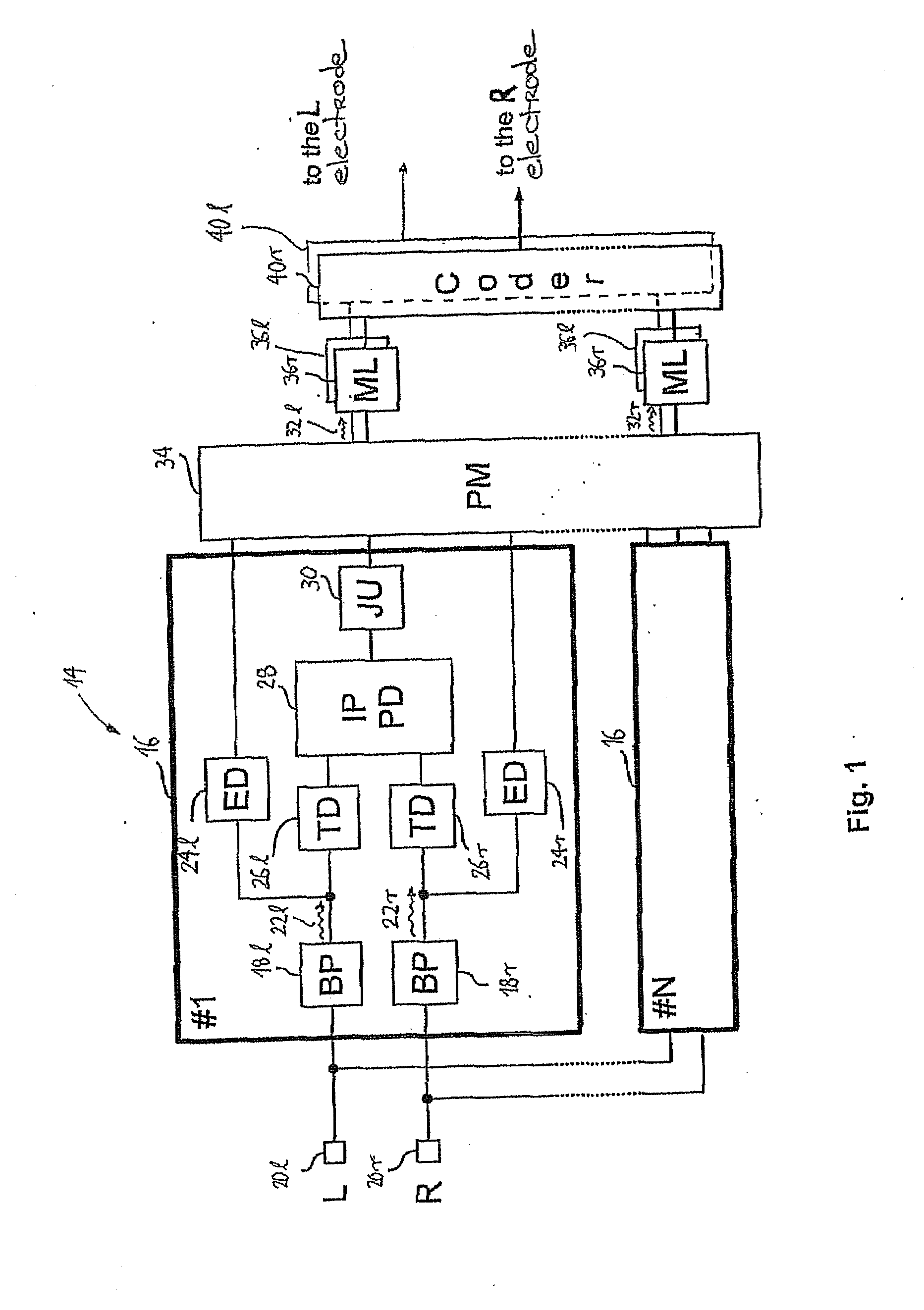 Binaural Stimulation in Neural Auditory Prostheses or Hearing Aids