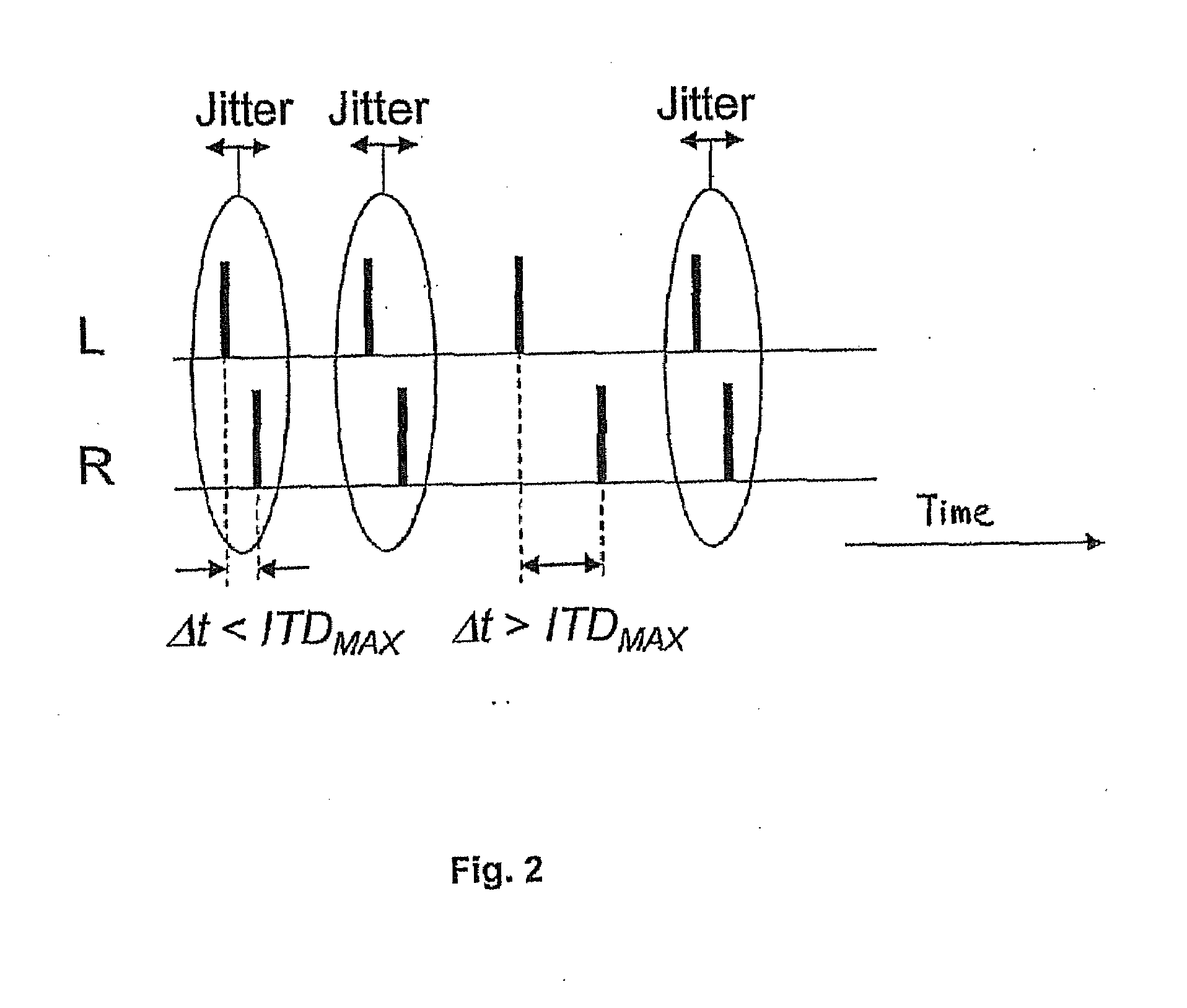 Binaural Stimulation in Neural Auditory Prostheses or Hearing Aids