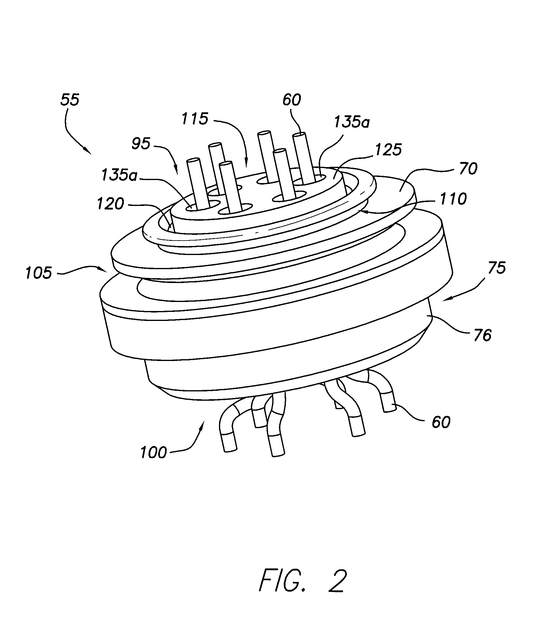 Implantable pulse generator EMI filtered feedthru using discrete capacitors