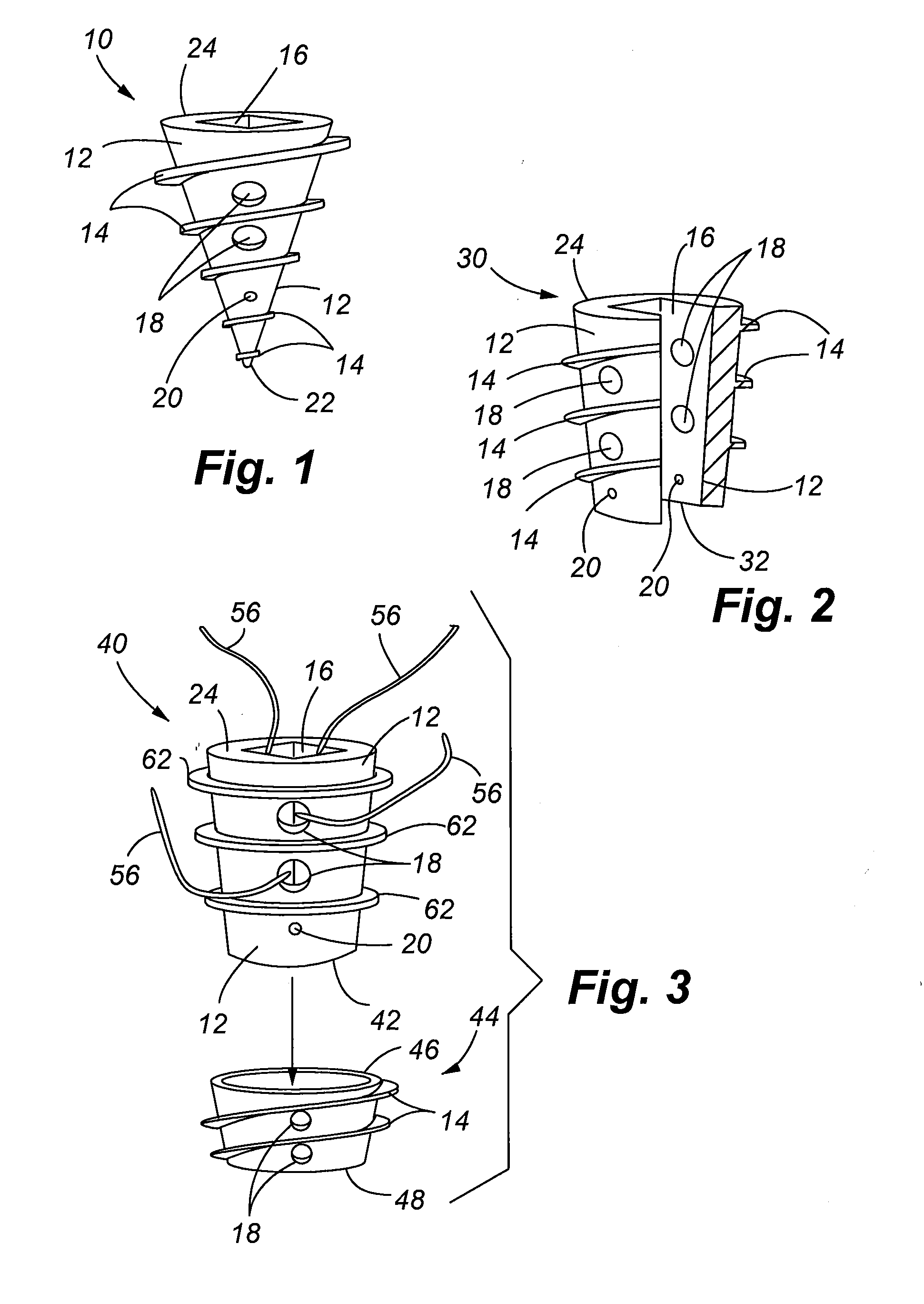 Bioelectric implant and method