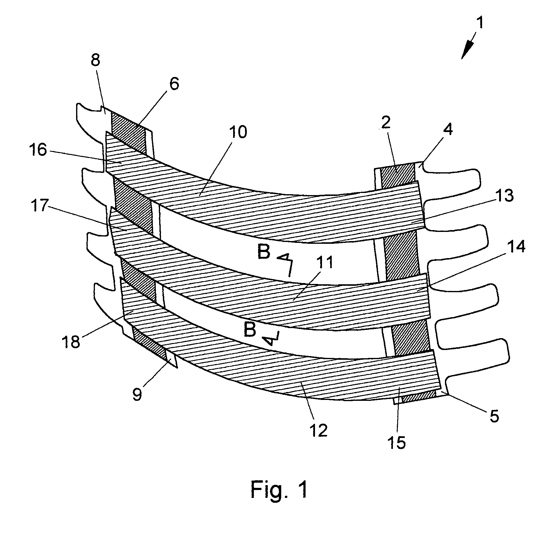 Method for splinting rib injuries