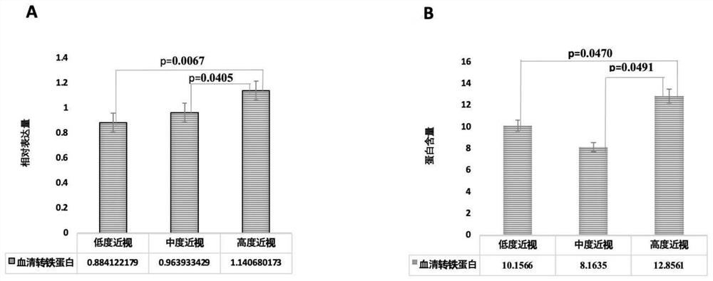 Iron metabolism related protein marker composition for high myopia risk prediction and high myopia auxiliary diagnosis and application of iron metabolism related protein marker composition