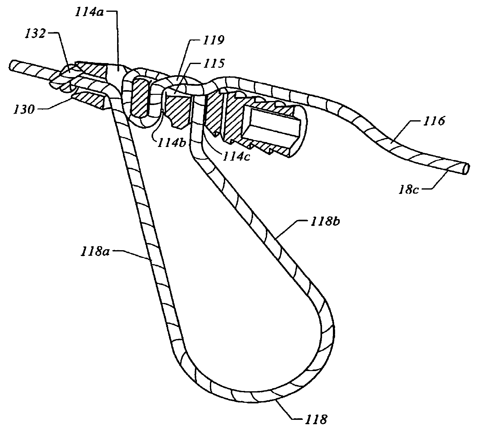 Knotless suture lock and bone anchor implant method