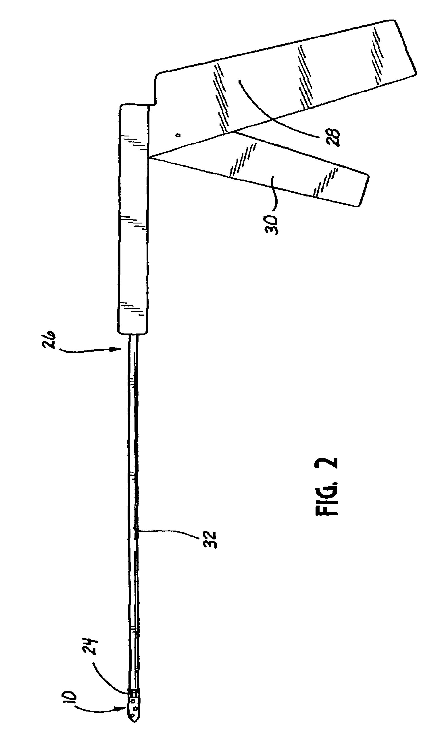 Knotless suture lock and bone anchor implant method