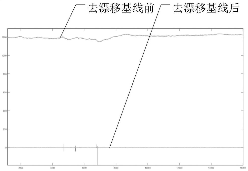 Pulse condition discrimination method based on deep learning