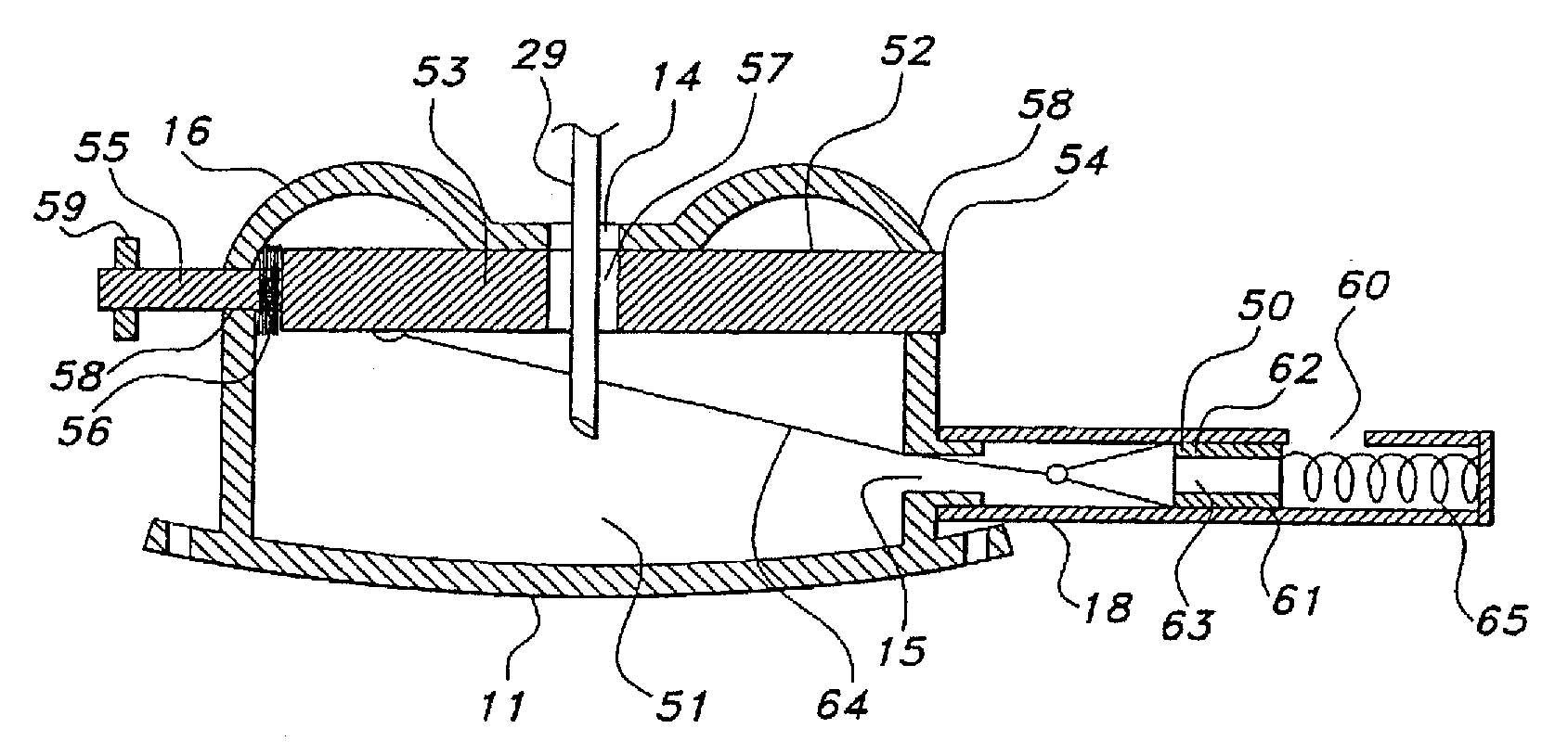 Implantable Vascular Access Device