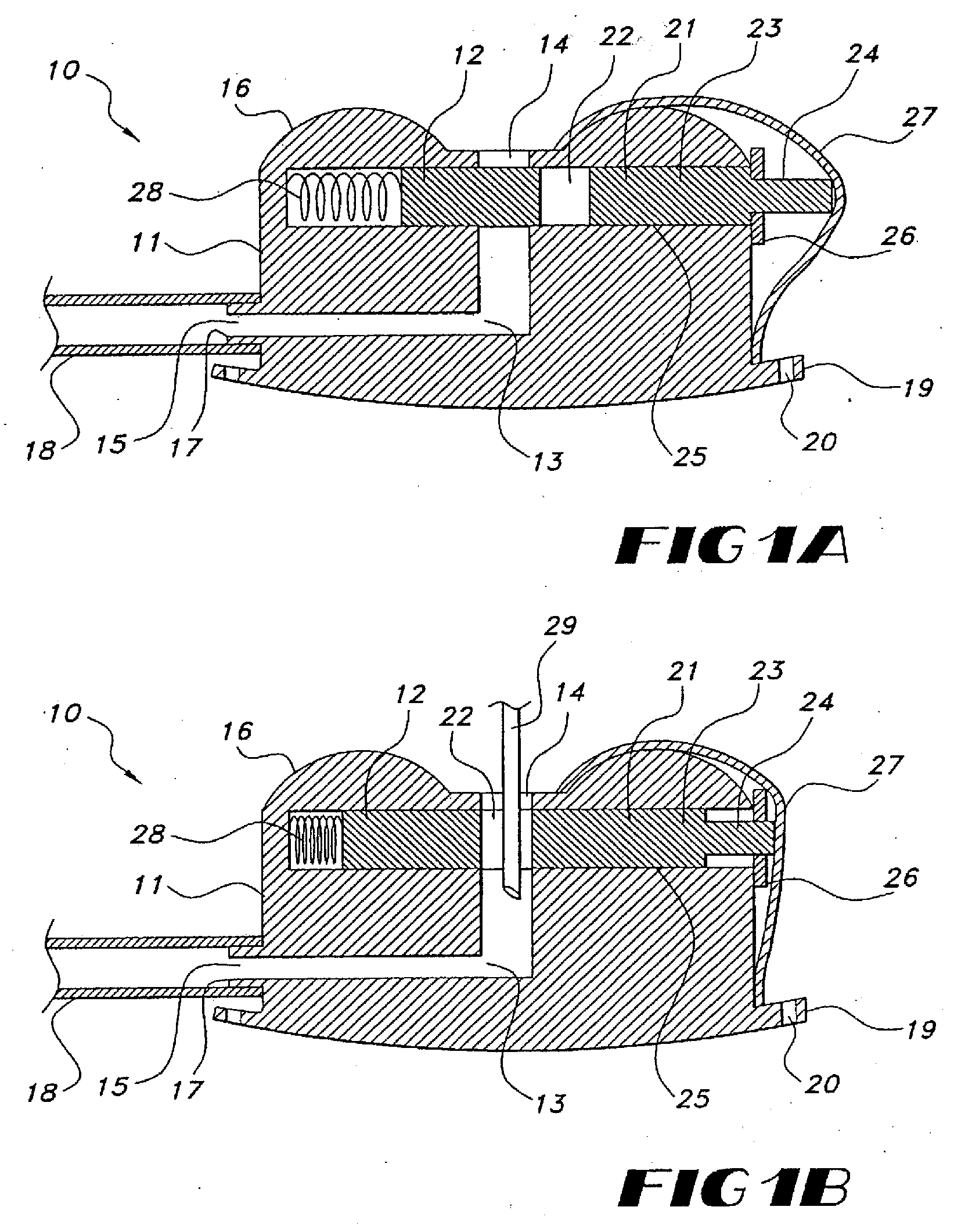 Implantable Vascular Access Device