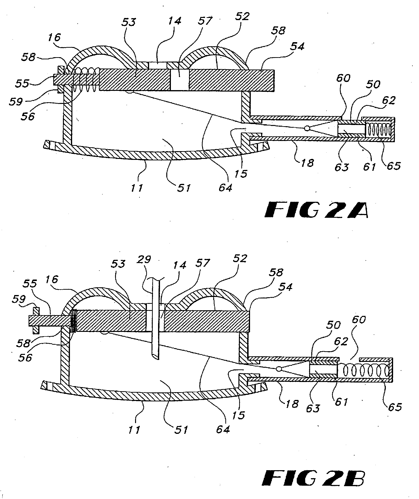 Implantable Vascular Access Device