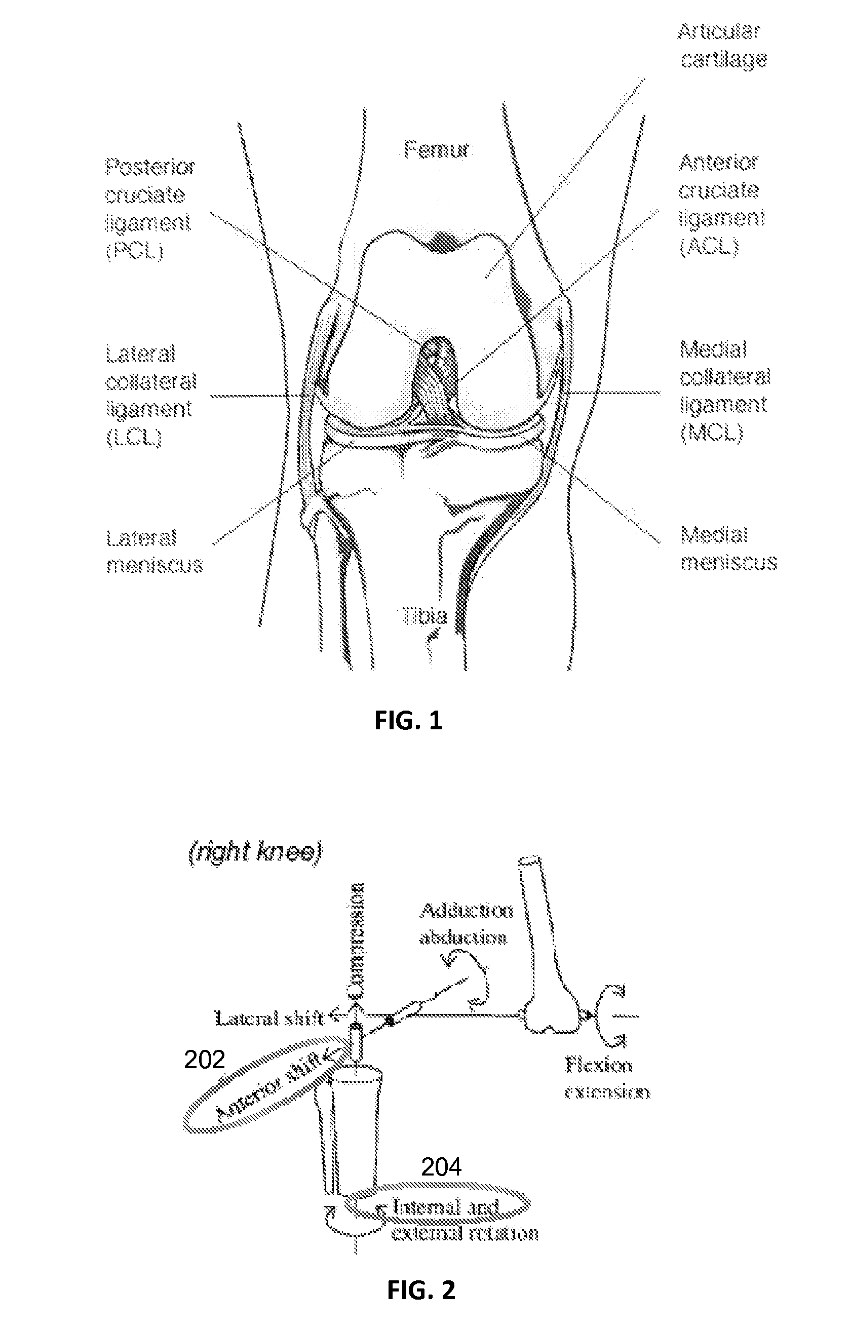 Mechanical pivot shift measurement to evaluate joints