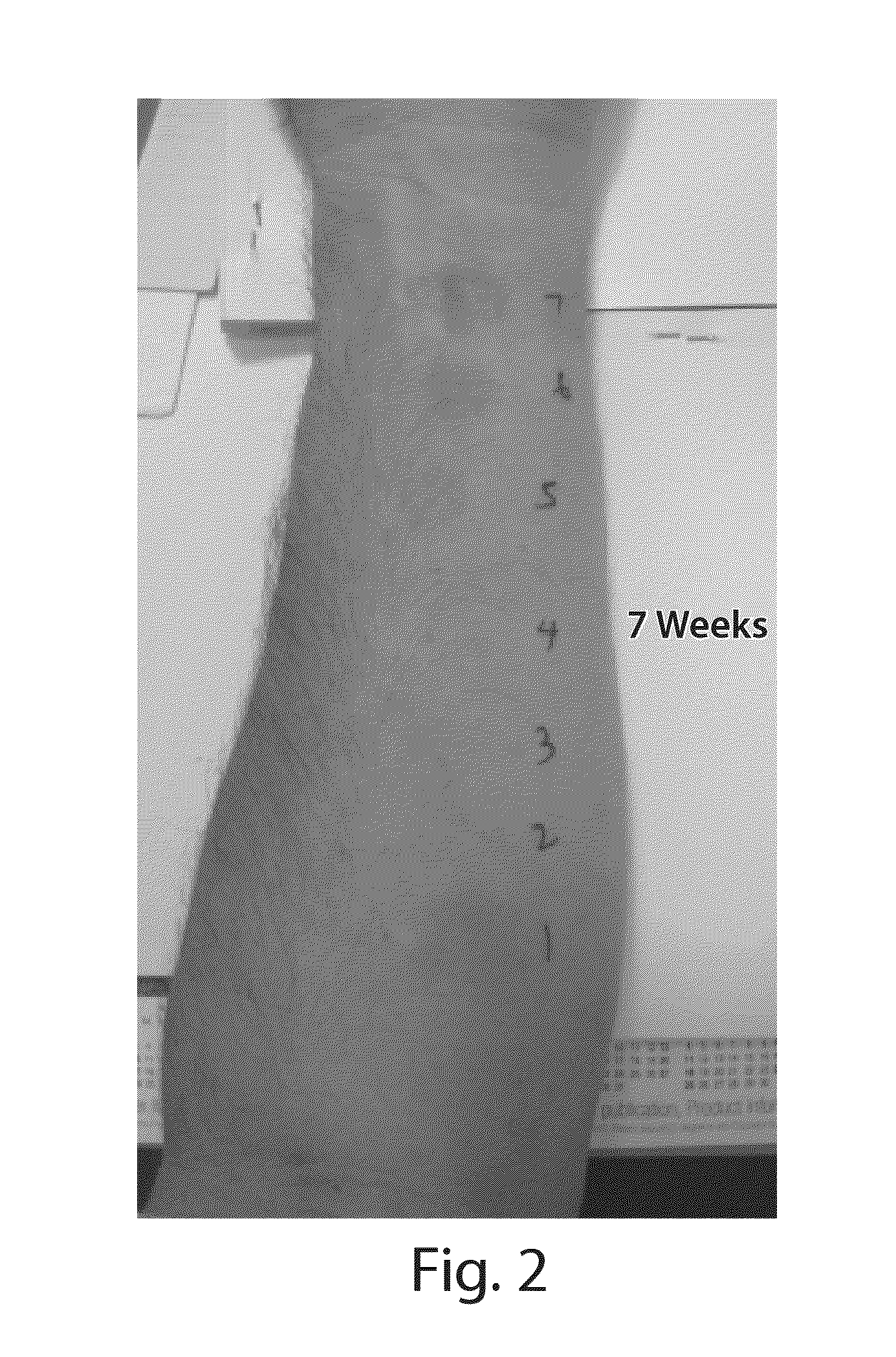 Tissue disruption treatment and composition for use thereof