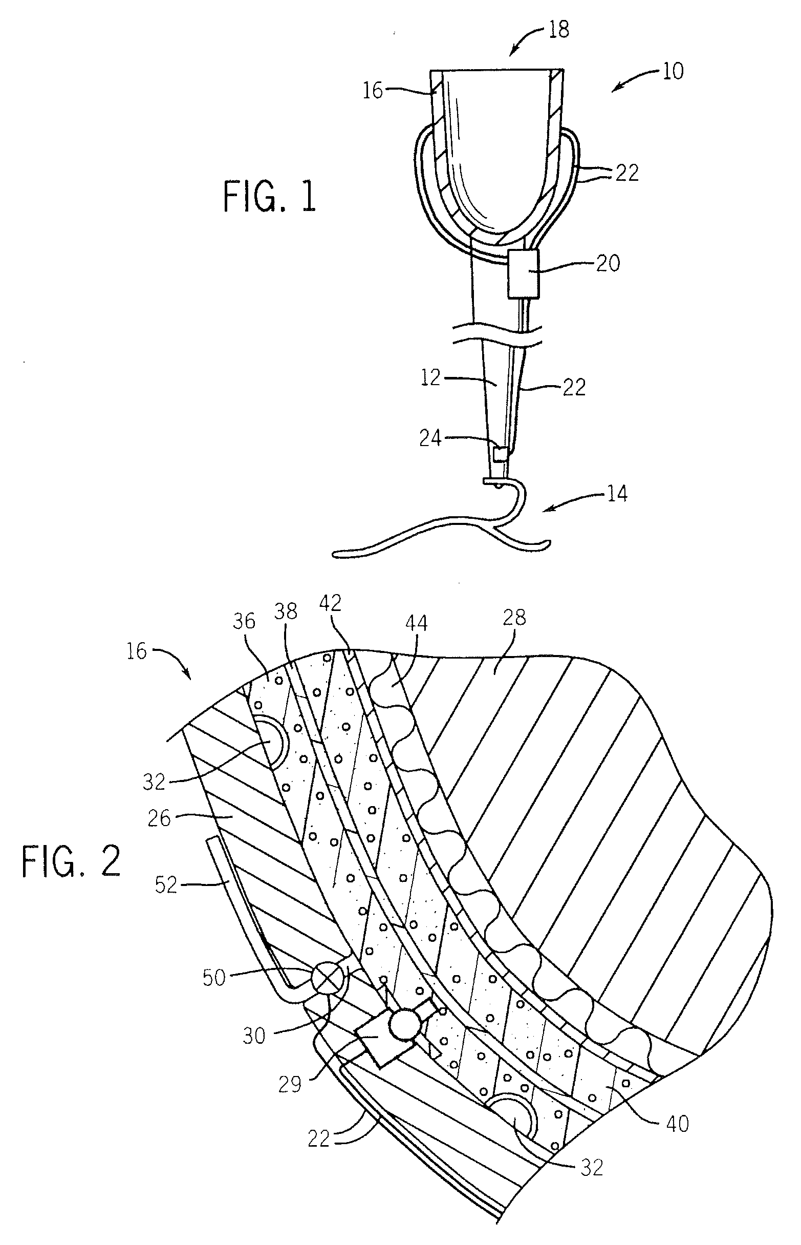 Prosthetic socket with real-time dynamic control of pressure points