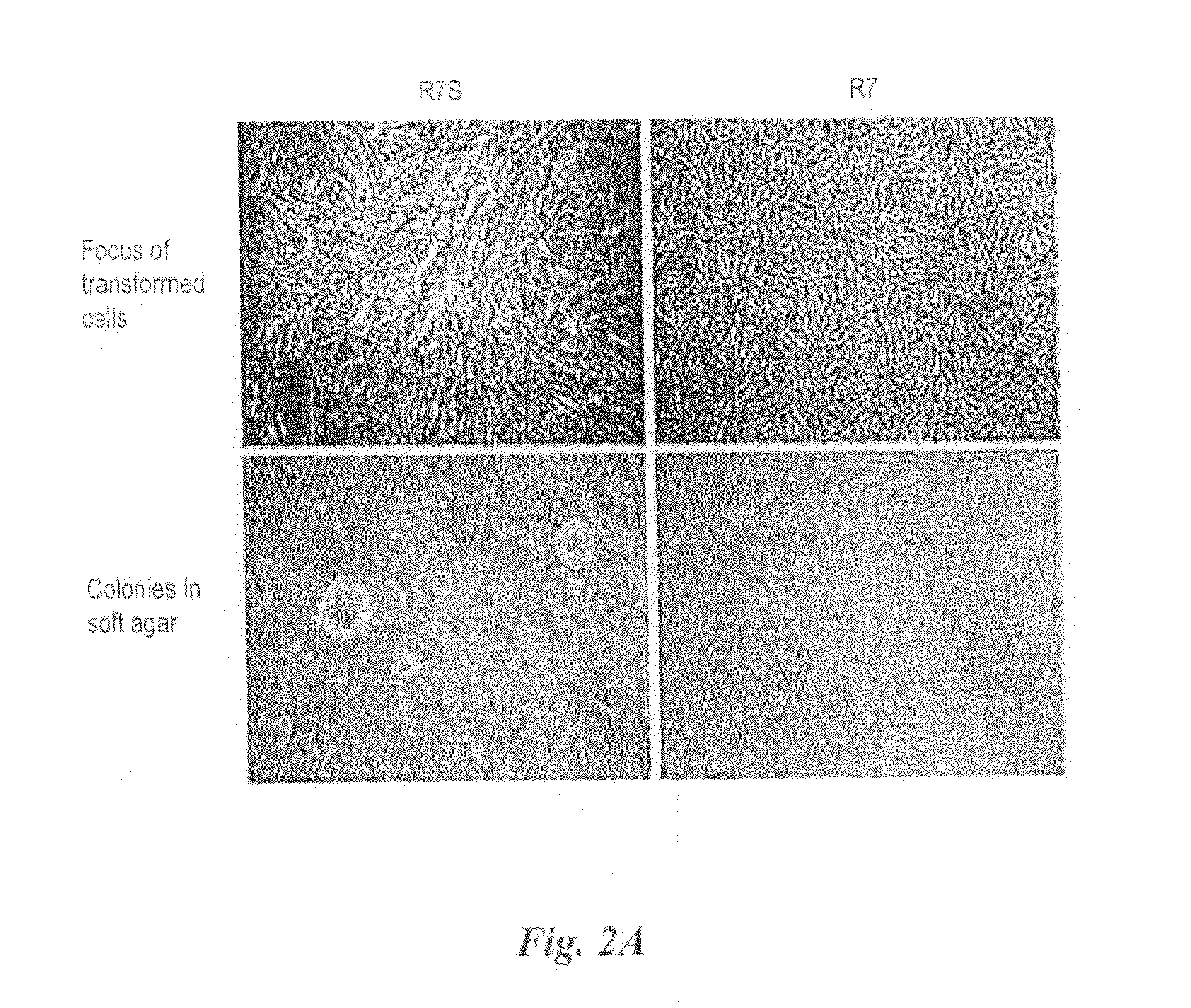 Method  for  preparing human  neoplastically  transformed  cells