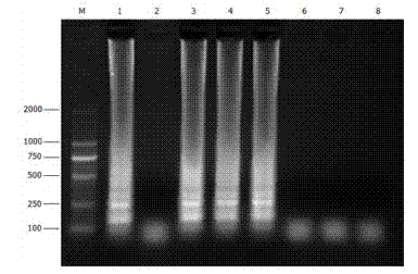 LAMP (loop-mediated isothermal amplification) kit for rapid detection of staphylococcus aureus