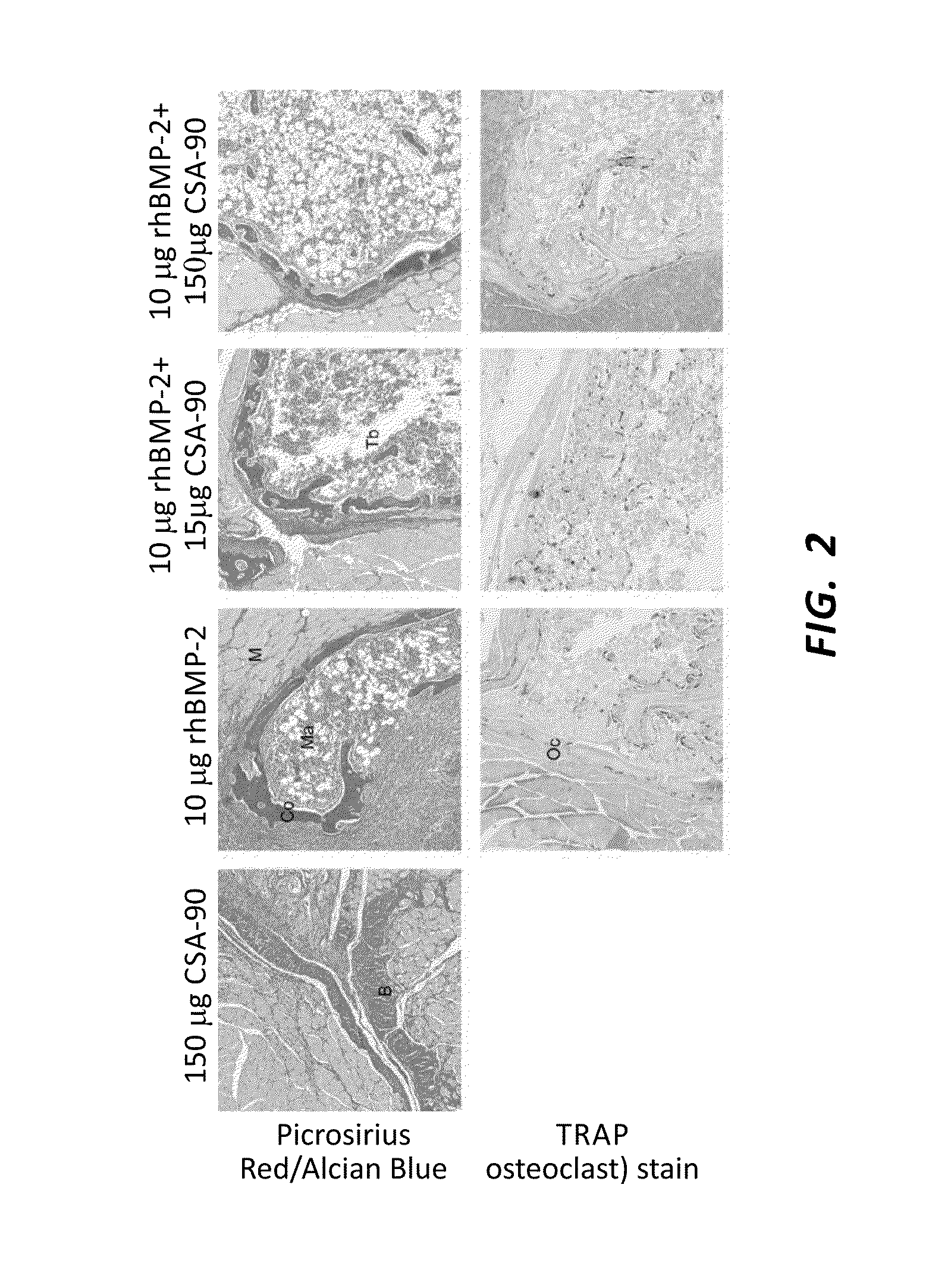 Anti-infective and osteogenic compositions and methods of use