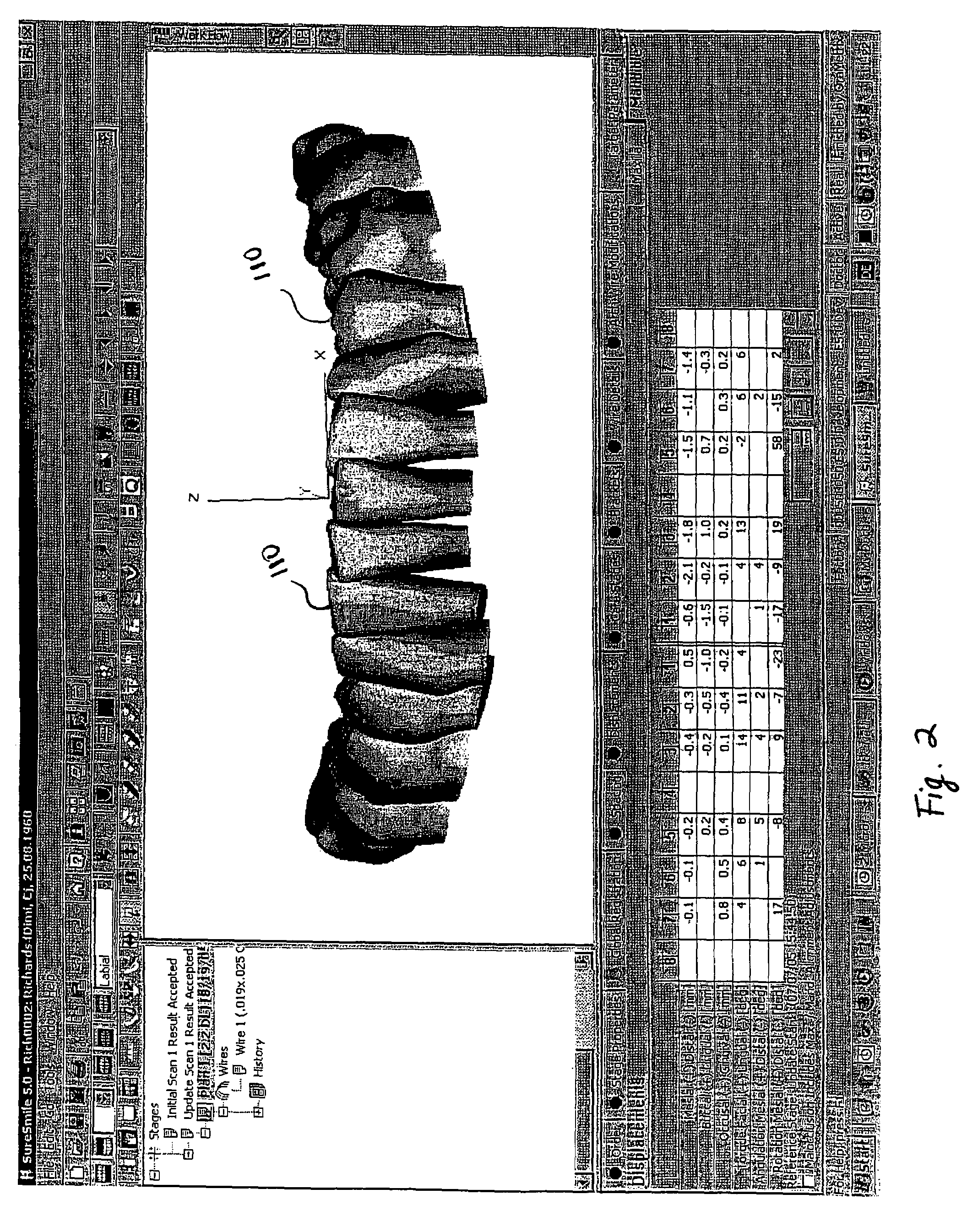 Method and apparatus for digitally evaluating insertion quality of customized orthodontic arch wire