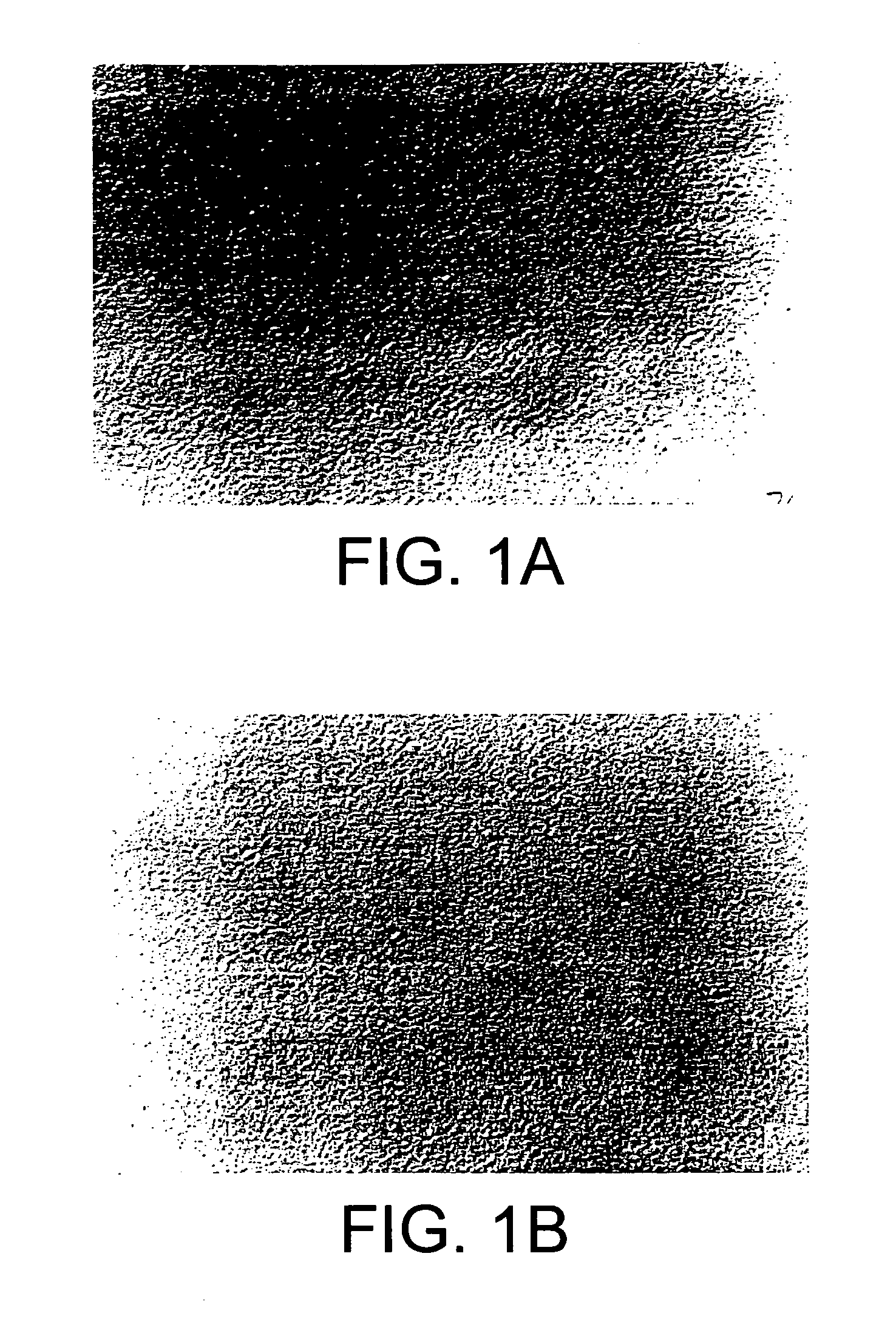 Efficient nucleic acid encapsulation into medium sized liposomes