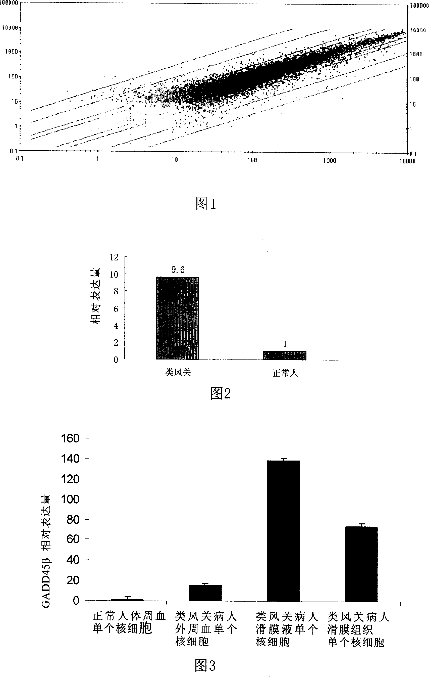 Use of GADD45 beta protein and its inhibitor in treatment of rheumatoid arthritis