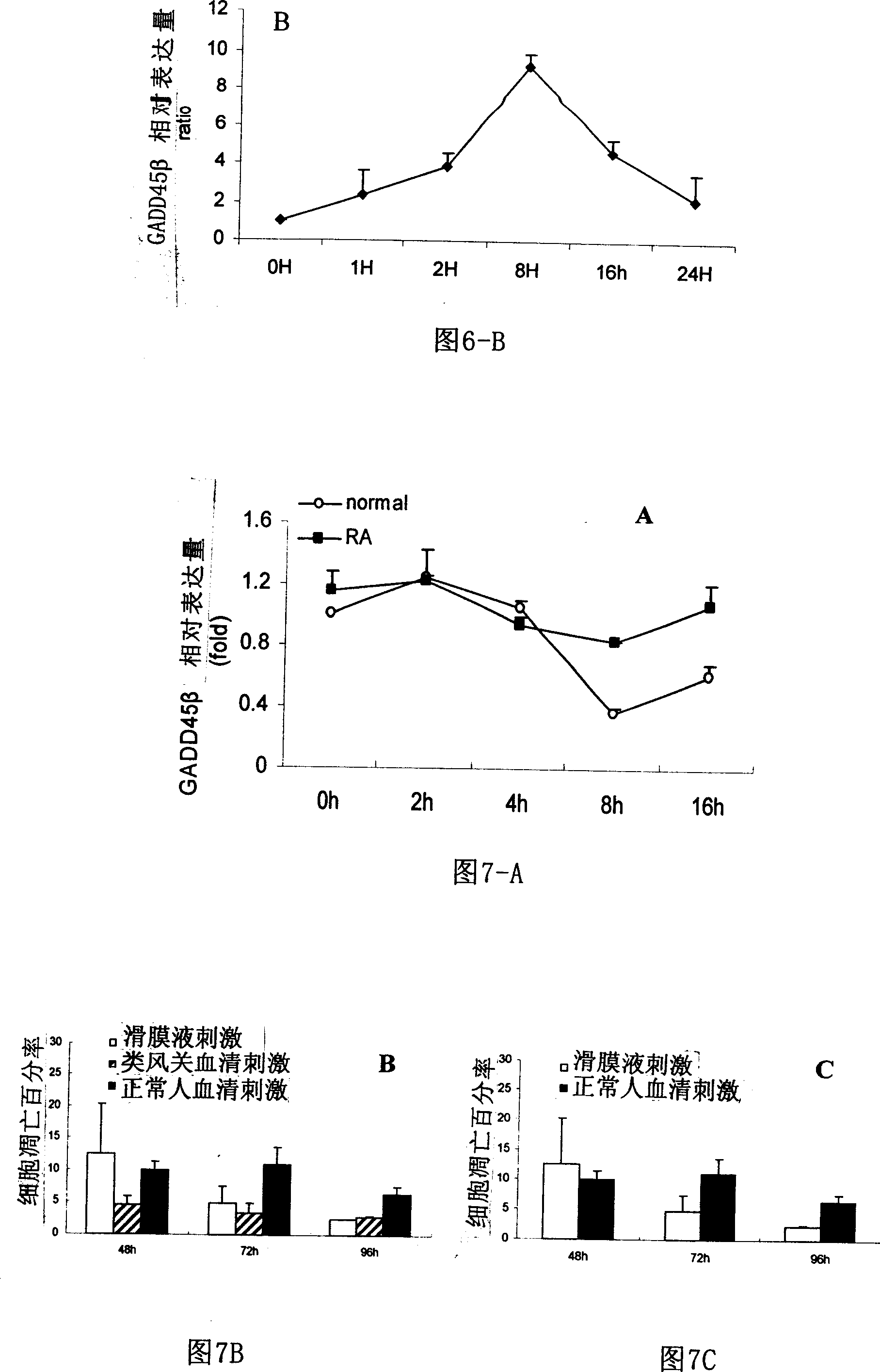 Use of GADD45 beta protein and its inhibitor in treatment of rheumatoid arthritis