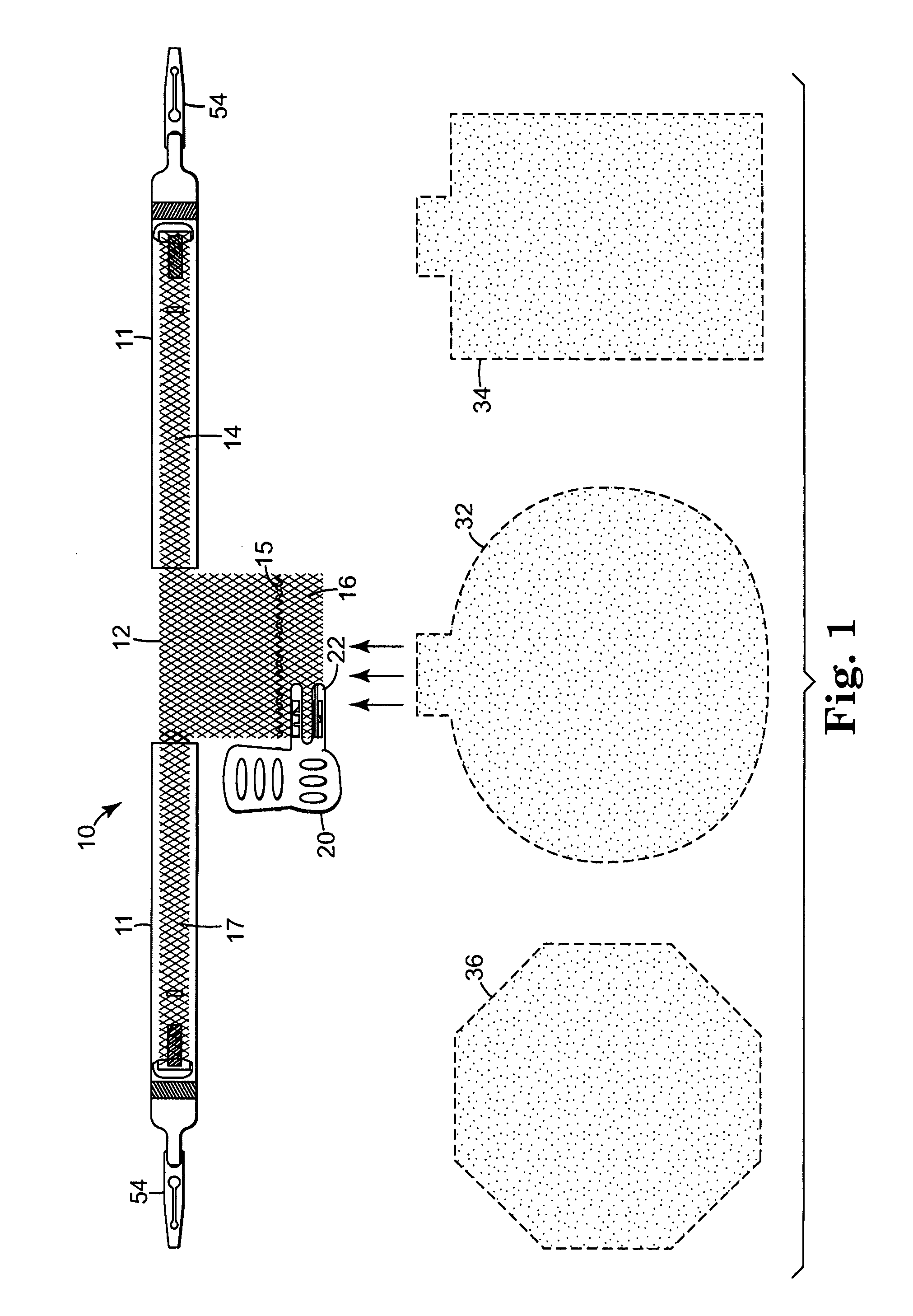 Pelvic health implants and methods