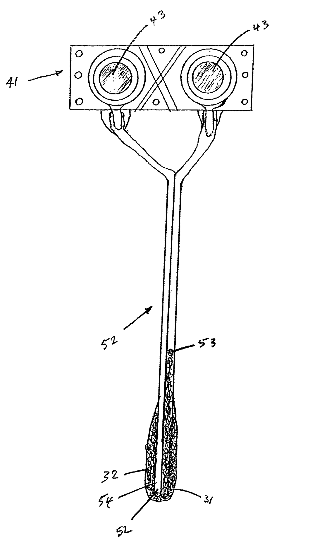 Implantable systems and stents containing cells for therapeutic uses