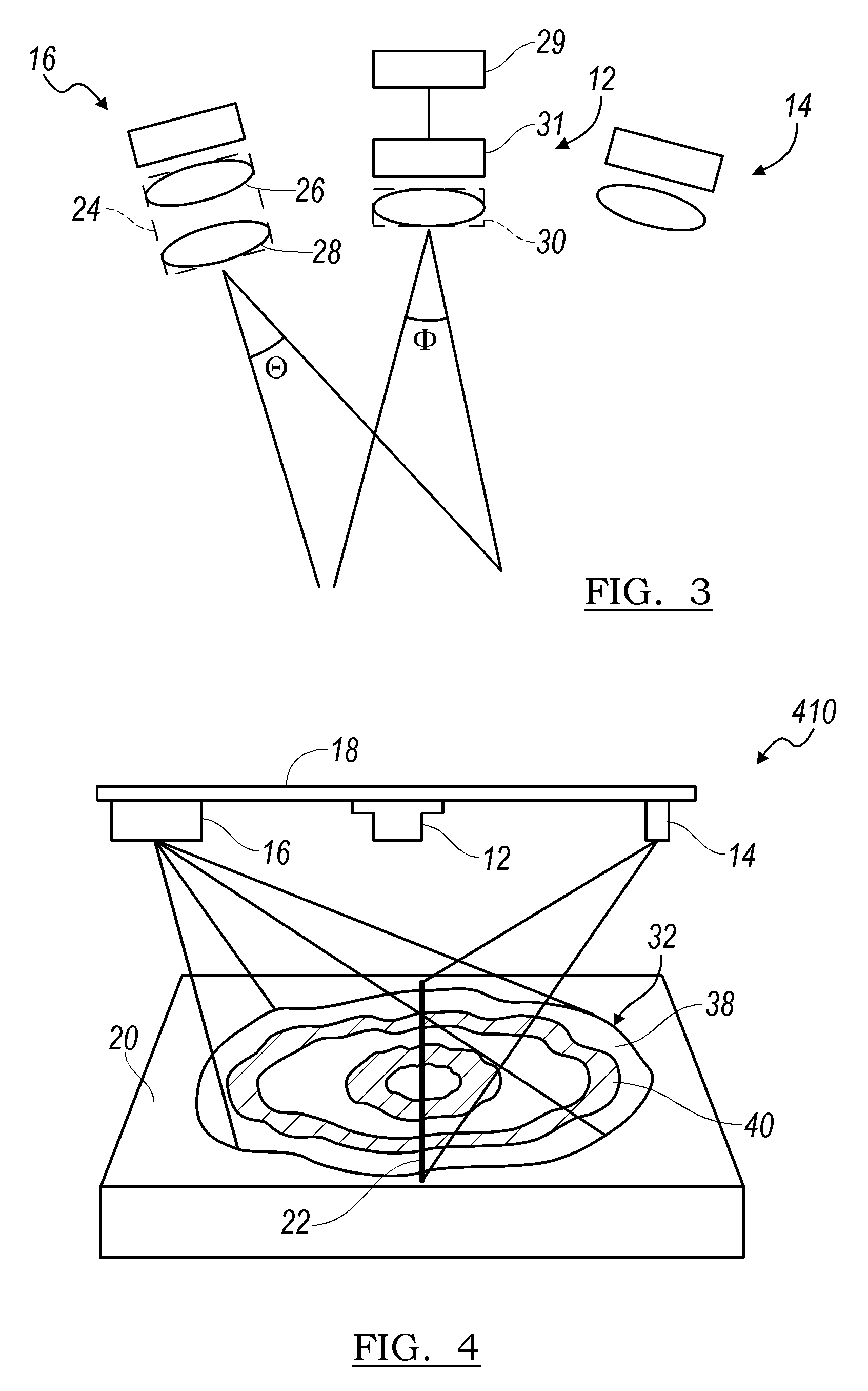 Sensor system and reverse clamping mechanism