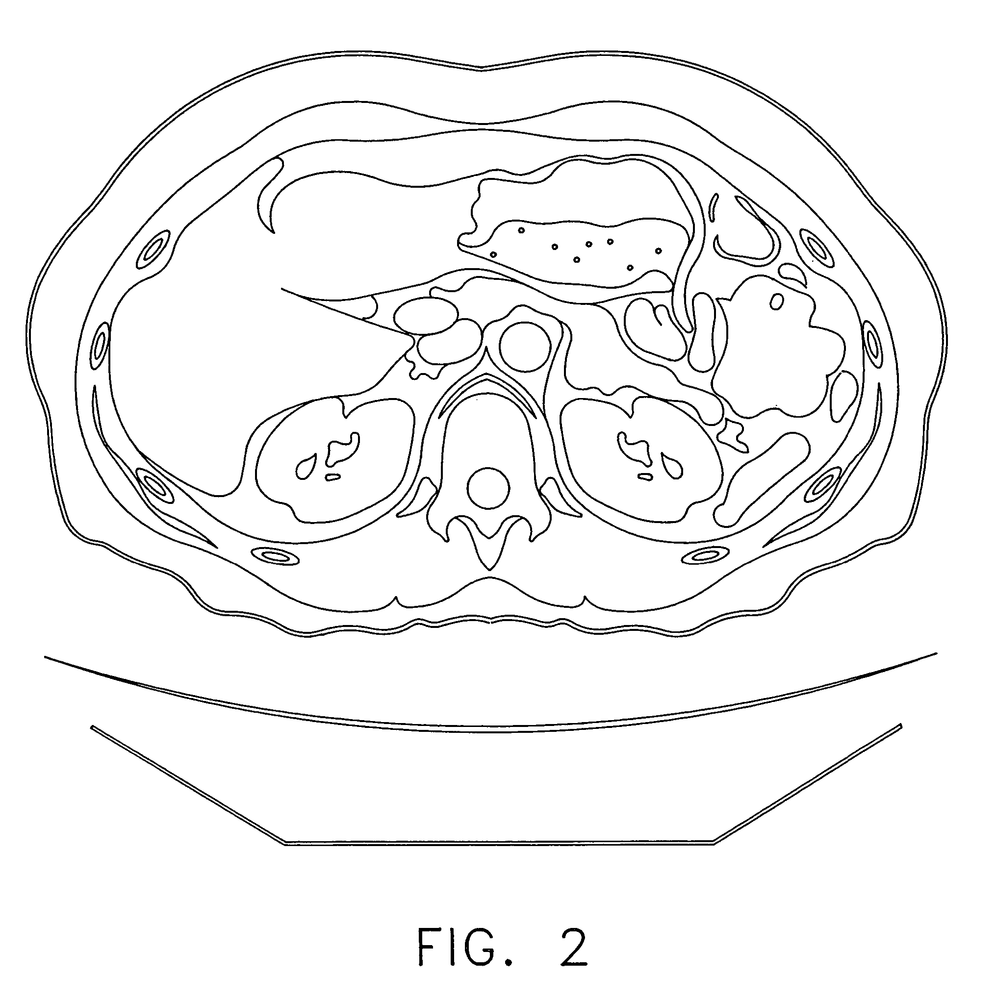 Anatomical visualization and measurement system