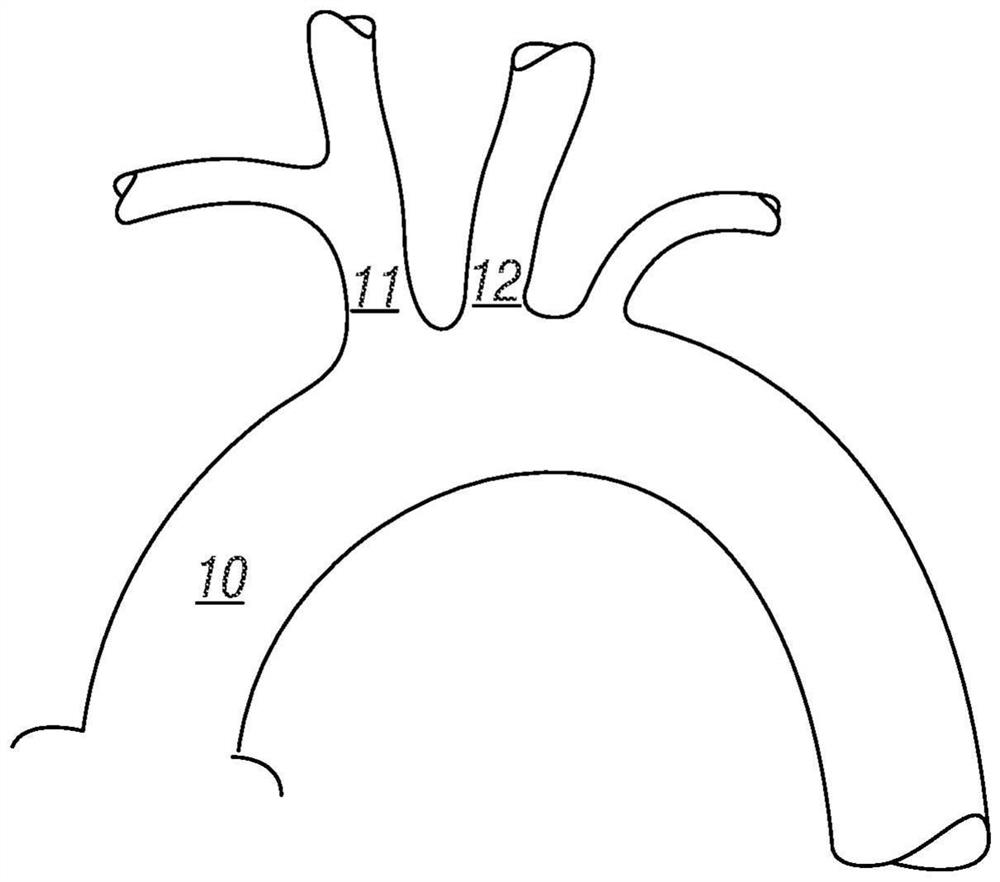 Fenestrated endoprosthesis for the correction of aortic aneurysms