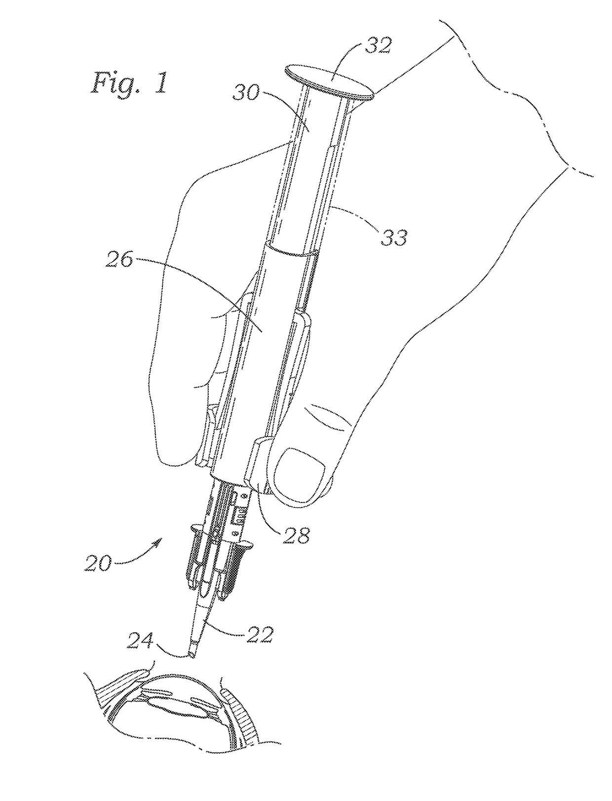 Automated preloaded intraocular lens injector