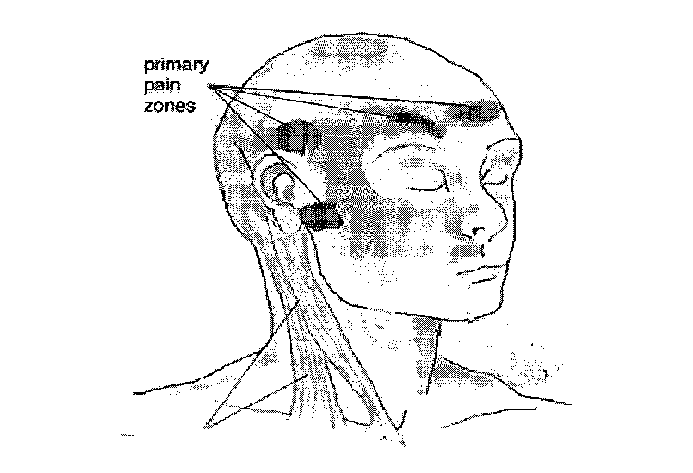 Methods and compositions for treating and preventing trigeminal autonomic cephalgias, migraine, and vascular conditions