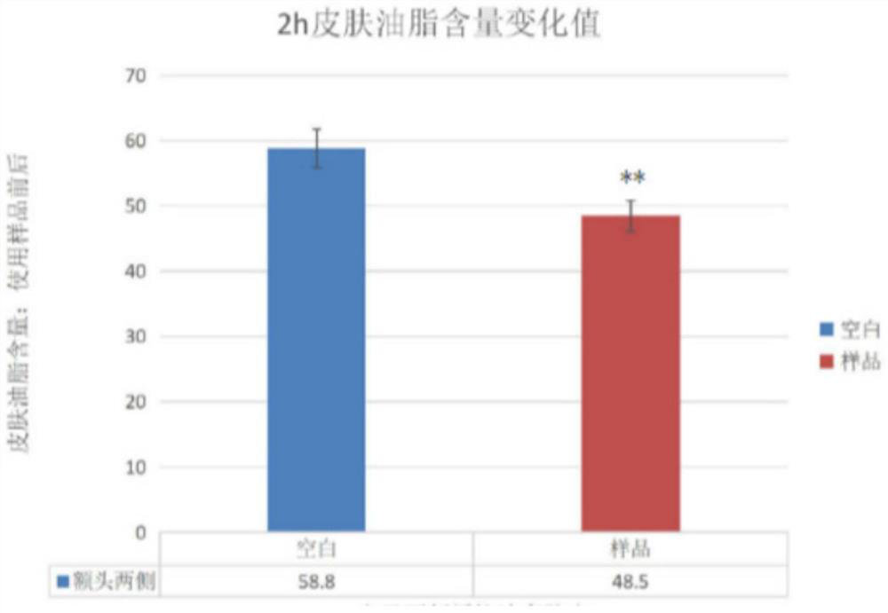 Oil-control, acne-removal and skin-care composition and preparation method thereof