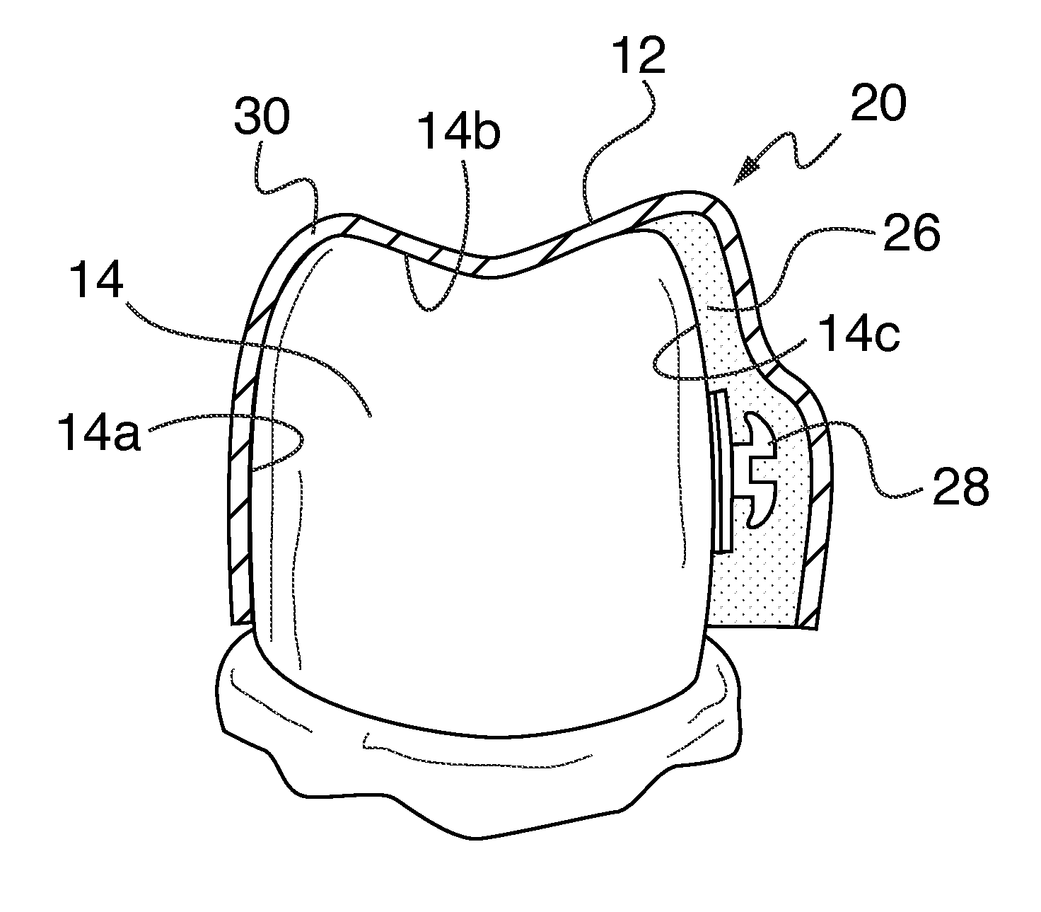 Orthodontic indirect bonding tray including stabilization features