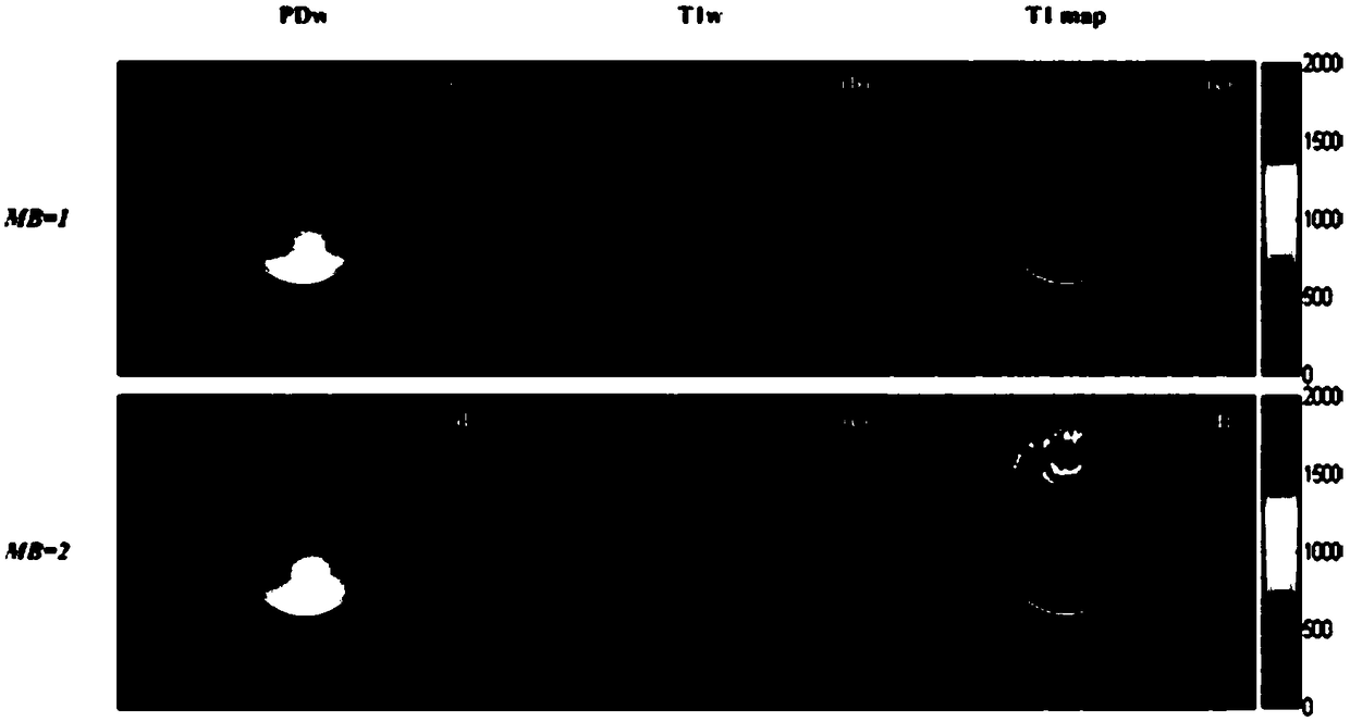 T1 parameter diagram imaging method and magnetic resonance imaging system