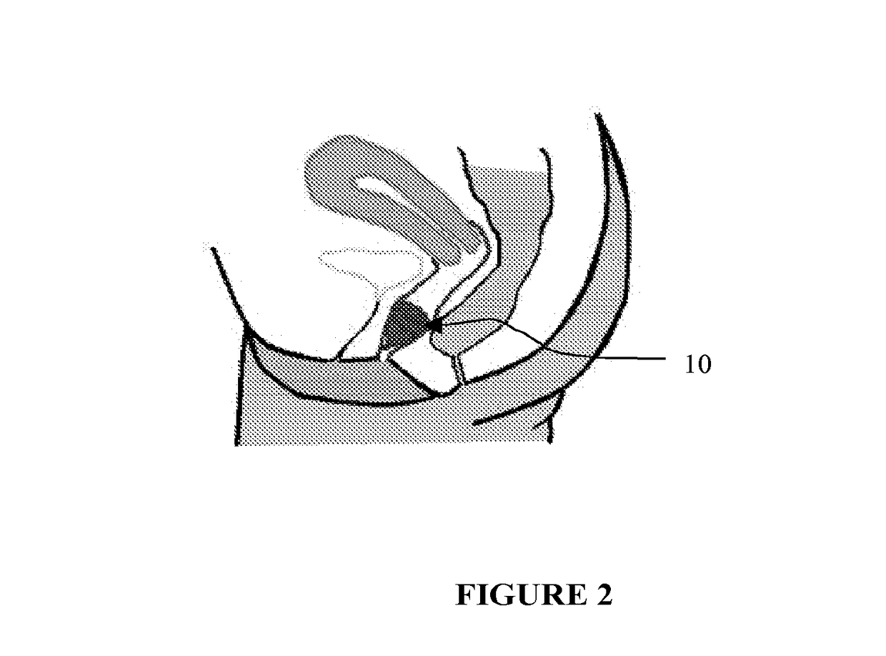 Drogue-like menses collection device