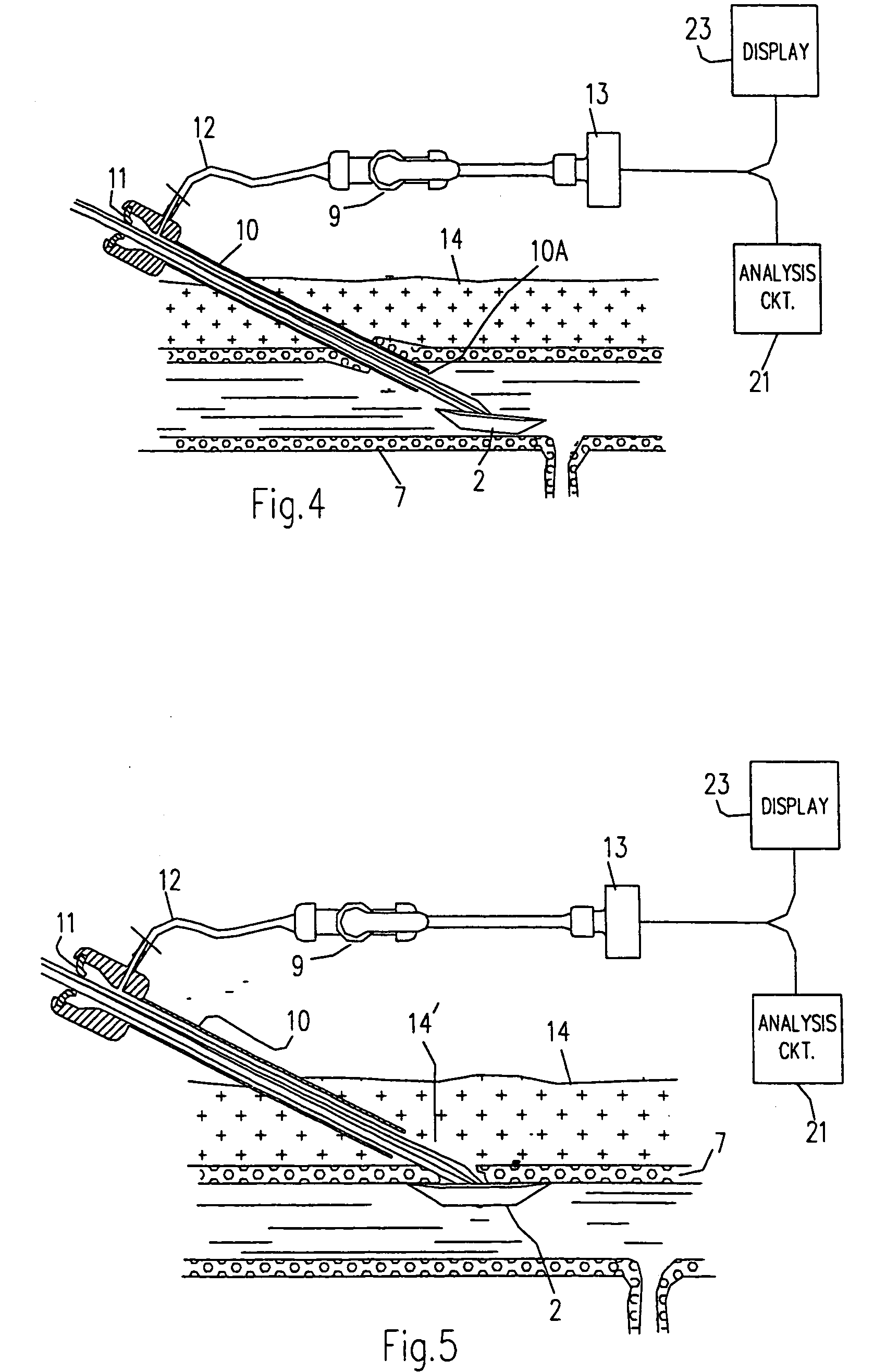 Technique to confirm correct positioning with respect to arterial wall