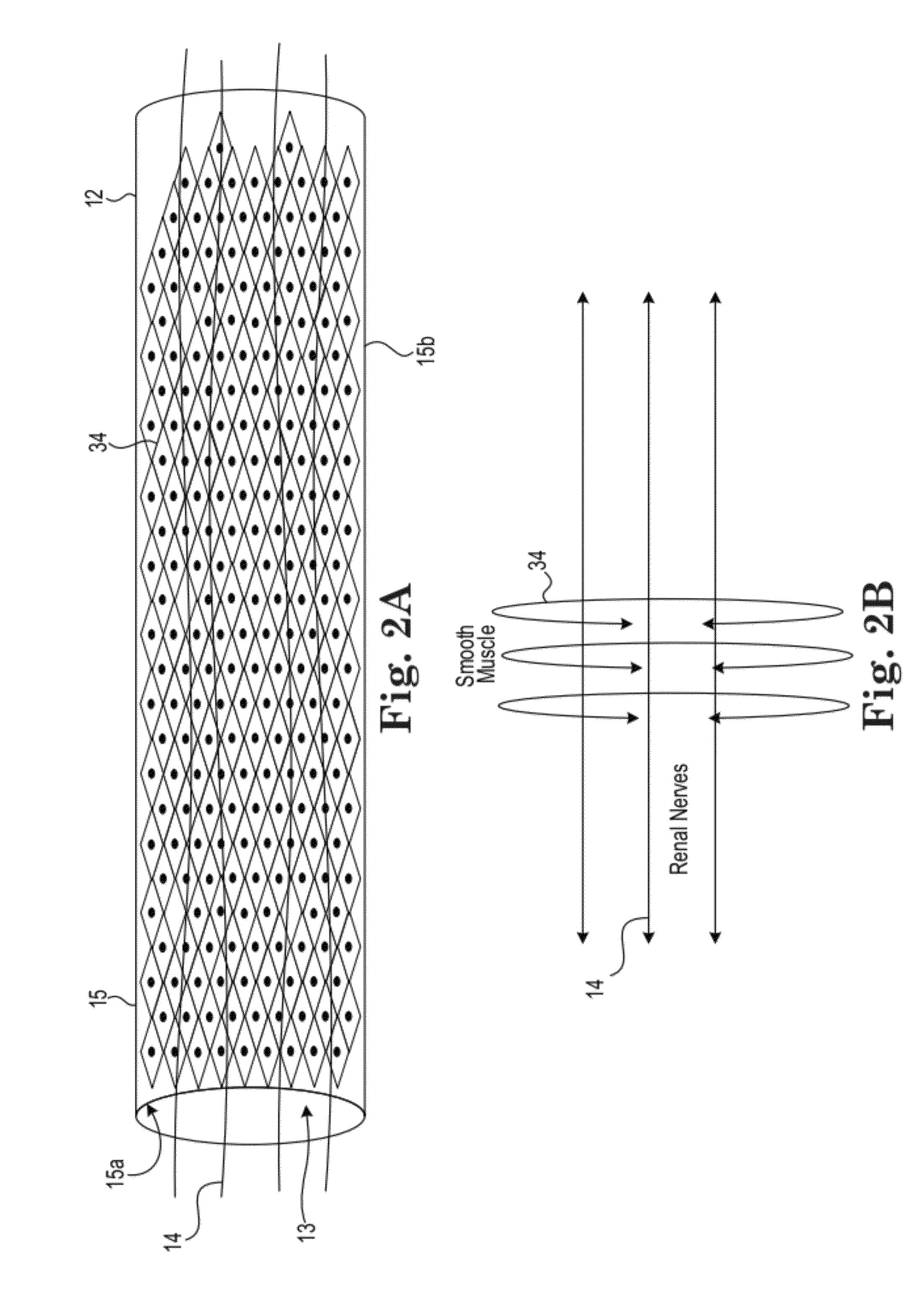 Renal nerve detection and ablation apparatus and method