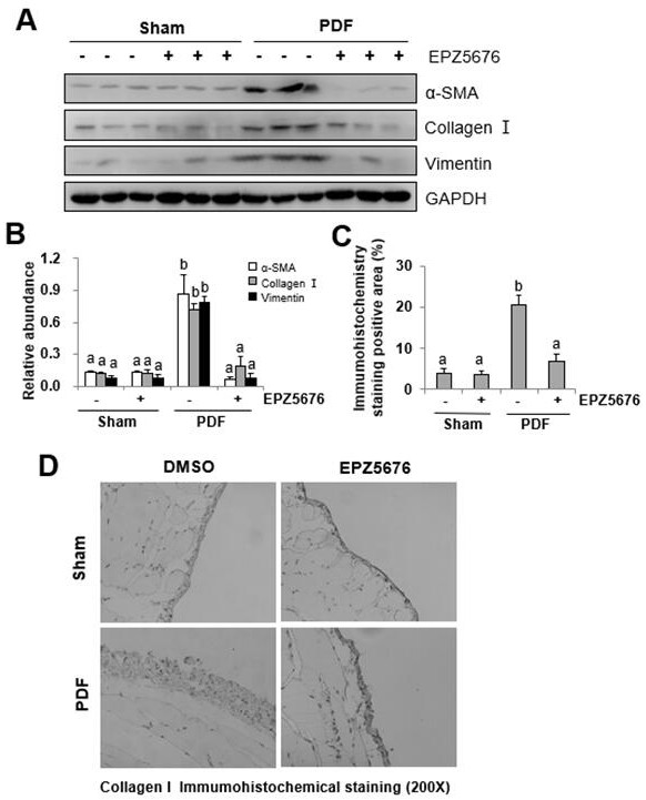 Application of inhibitor of histone methyltransferase DOT1L in preparation of medicine for preventing and treating peritoneal fibrosis after peritoneal dialysis