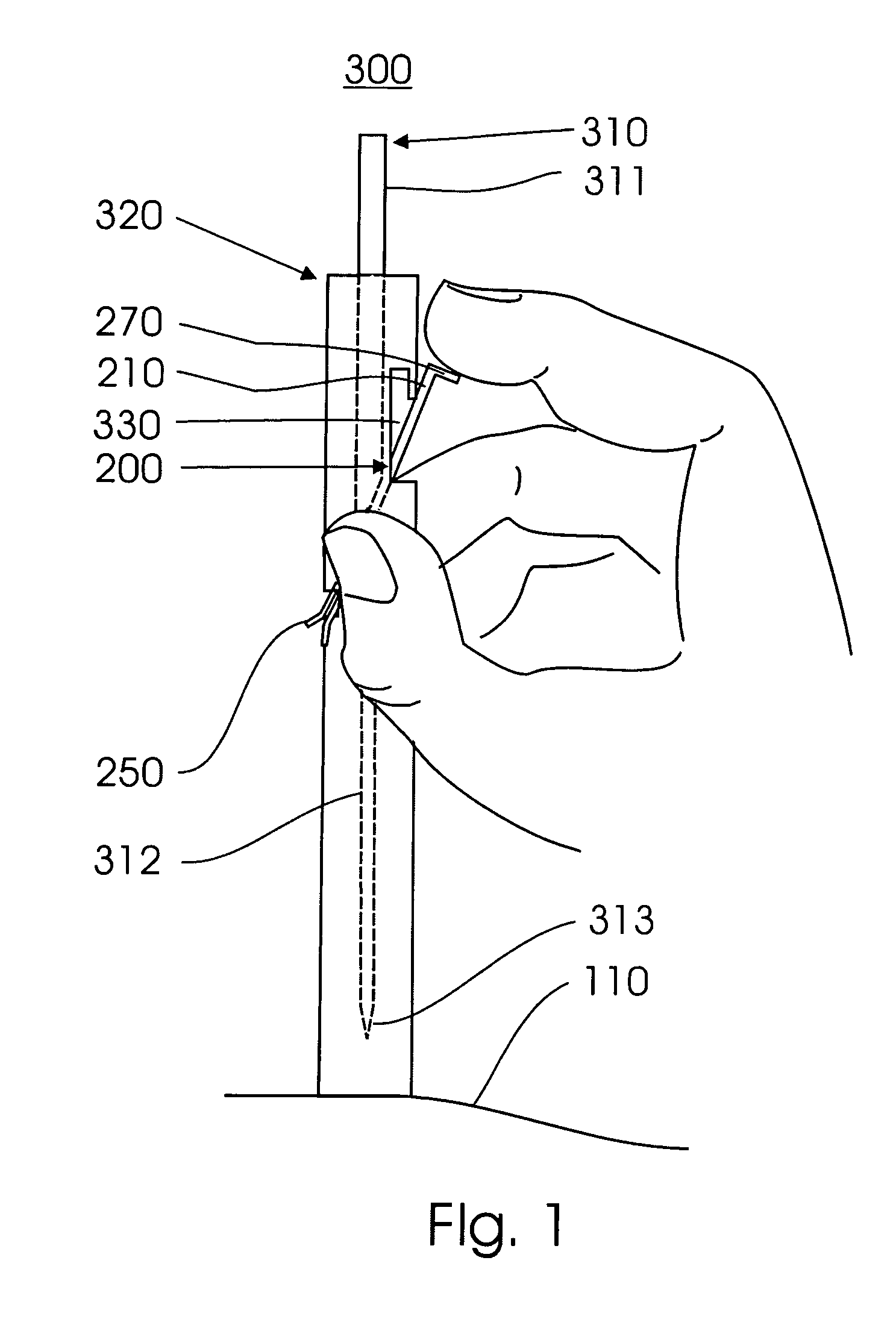 Clip for acupuncture needle