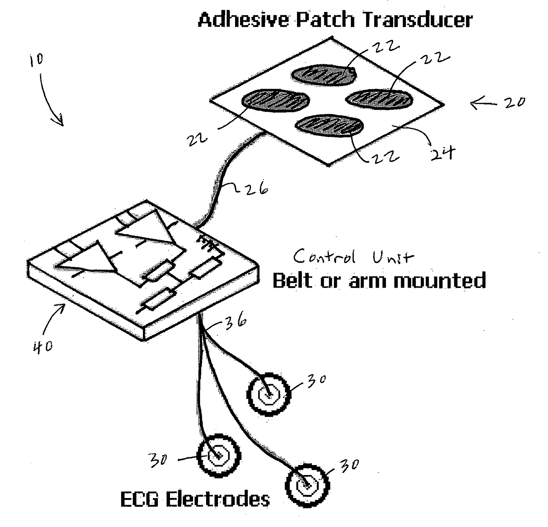 Noninvasive Ultrasound Cardiac Pacemaker and Defibrillator